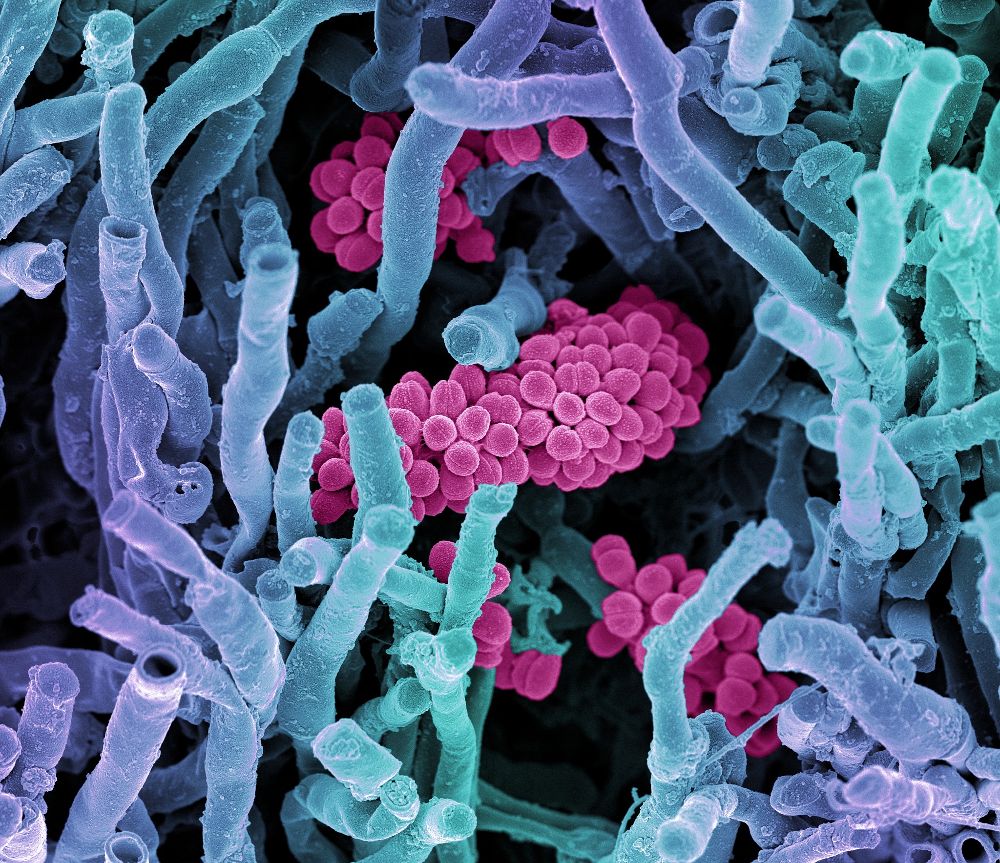 微生物植物生长过程中土壤有效氮会降低当微生物和植物在土壤中生长时它们会消耗土壤中的有效氮。微生物会利用土壤中的有机质进行代谢活动产生一些废物其中包括氨和尿素等化合物。这些化合物会进一步分解成硝酸盐和亚硝酸盐等形式的氮从而降低土壤中的有效氮含量。植物也会吸收土壤中的氮从而降低土壤中的有效氮含量。因此随着微生物和植物的生长土壤中的有效氮含量逐渐降低。继续