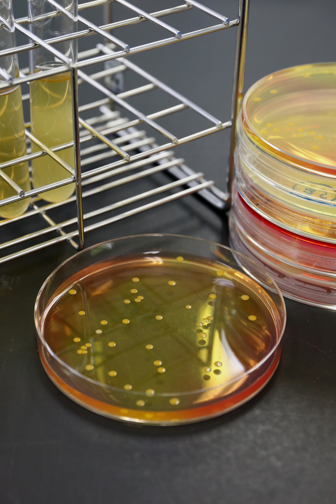 连续3篇日记关于小明和1个同学乱吃东西感染致泻性大肠杆菌一起在学校拉肚子两个人上课不断去厕所拉肚子一节课至少一次