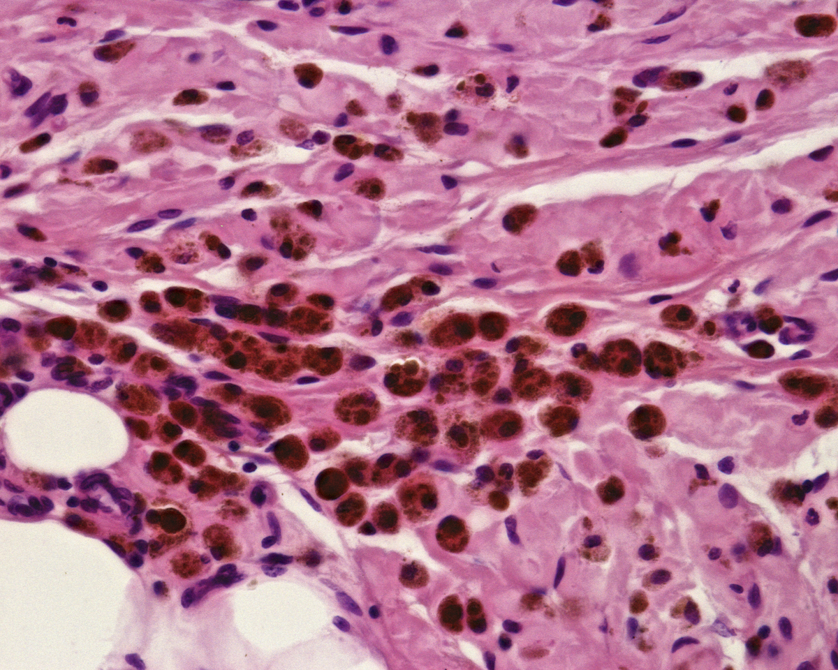请用地道、专业、科学、书面化的中文翻译如下内容：Endometrial Tissue Collection and Optimization of Decellularization ProtocolHeifers Bos taurus Angus age 12–18 mo were housed in a fenced open paddock with unfettered access to