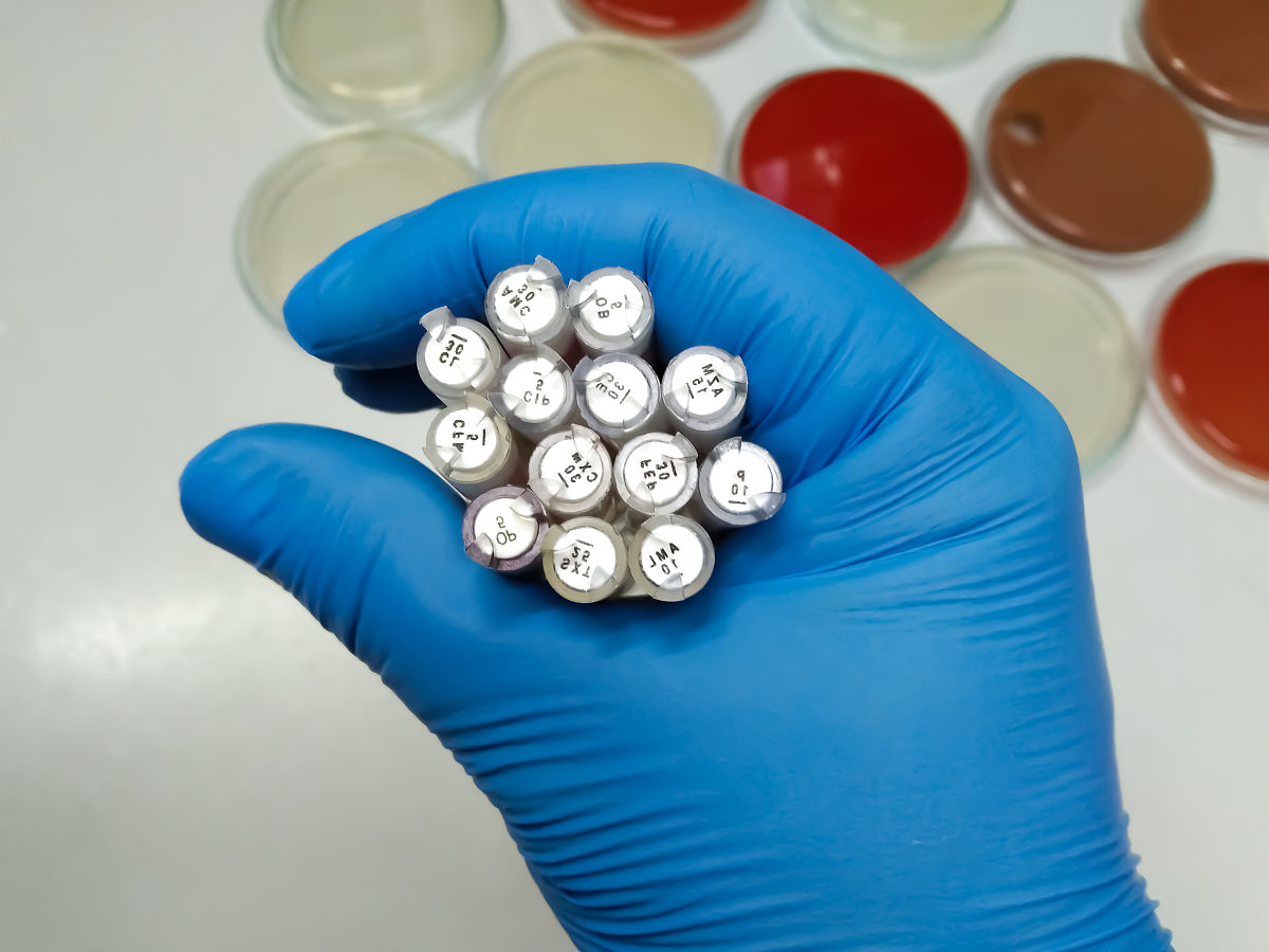 善抗生素药物管理制度：合理用药，守护健康