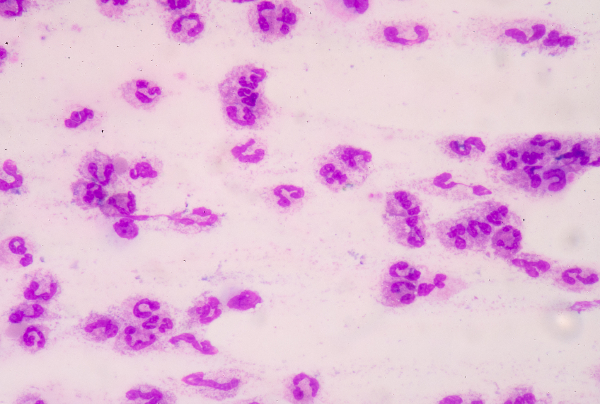 脓毒症心肌病发病率