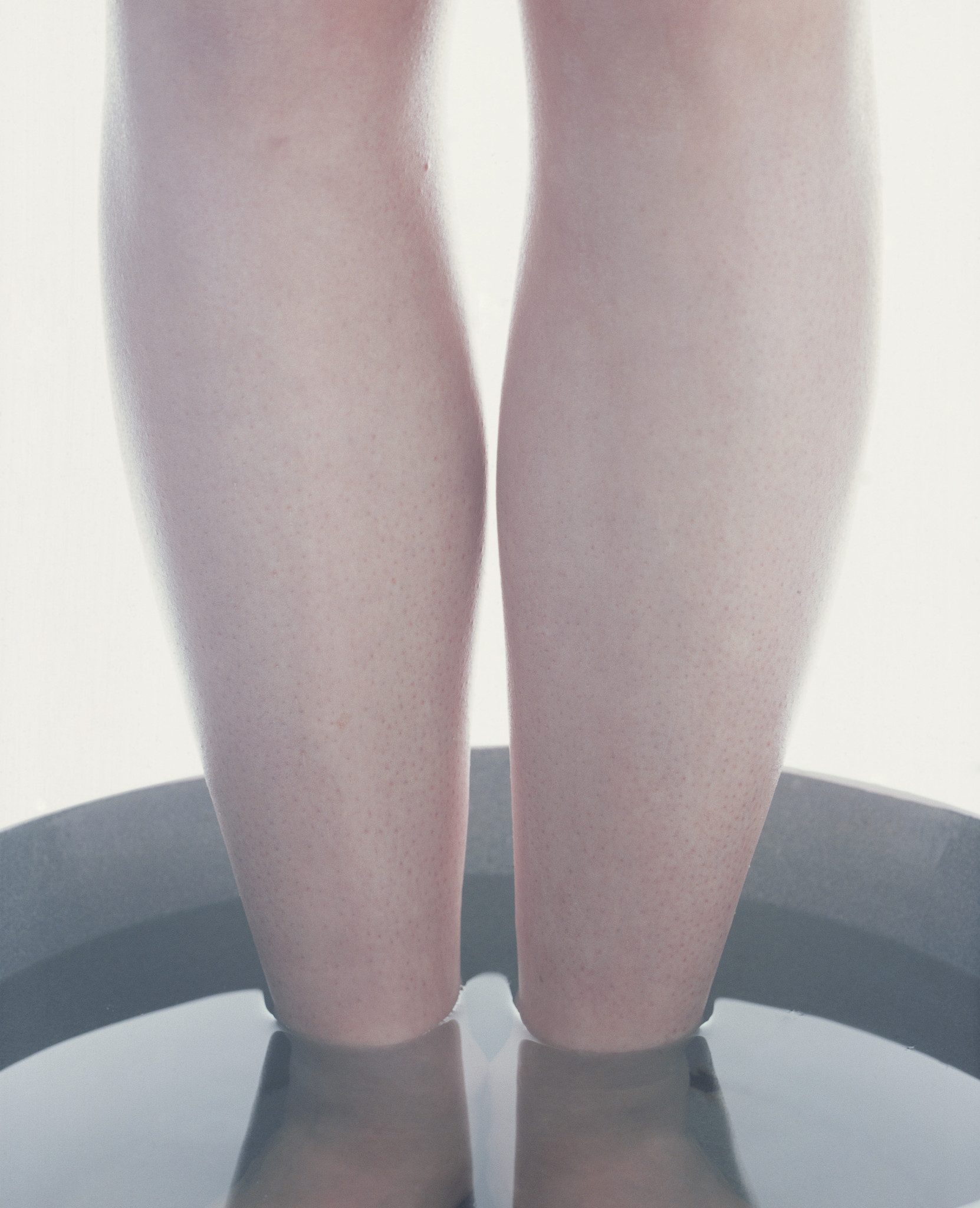 大腿脂肪环吸：朋友圈爆款文案，让你拥有纤细美腿！