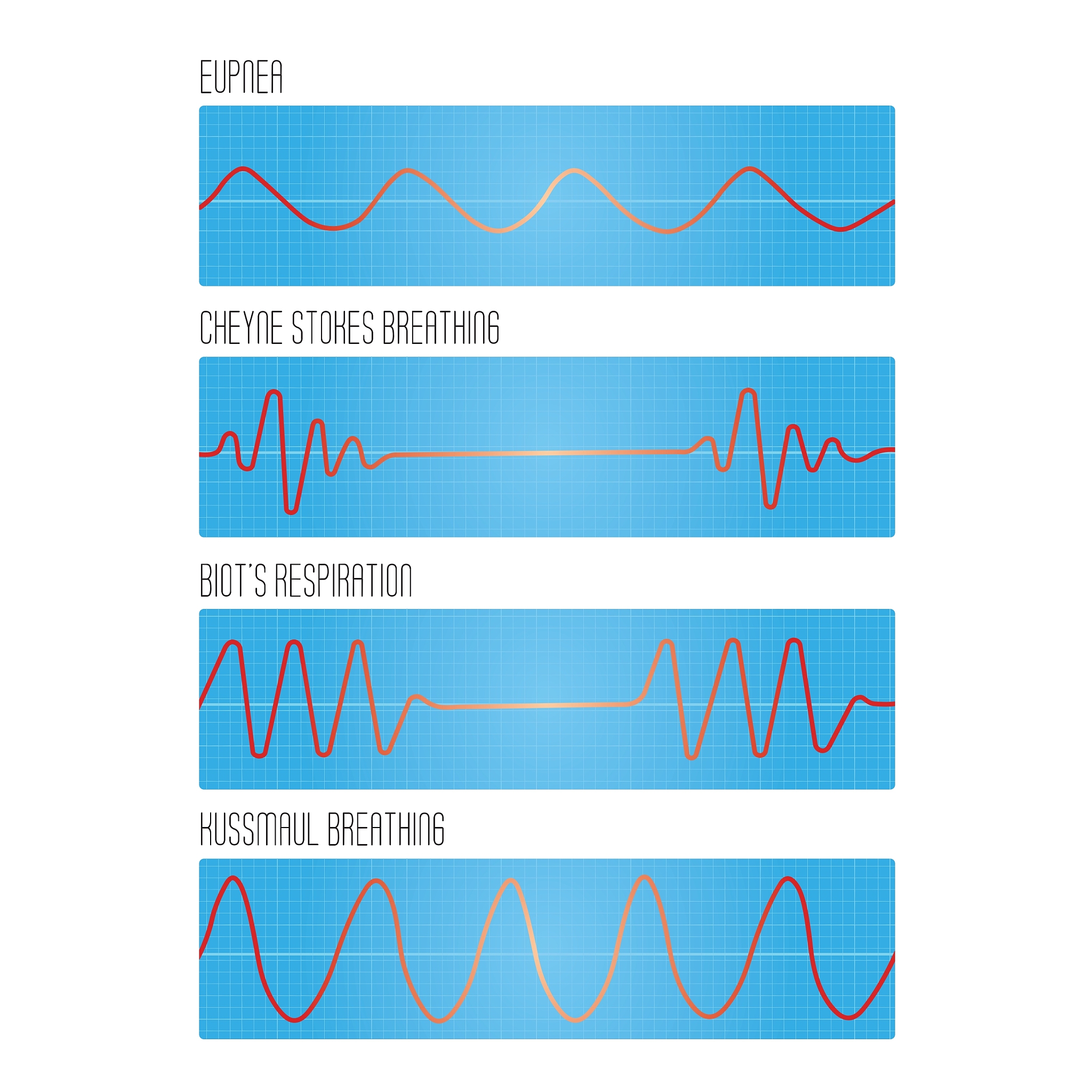 生理同步与A中的吸引力有关