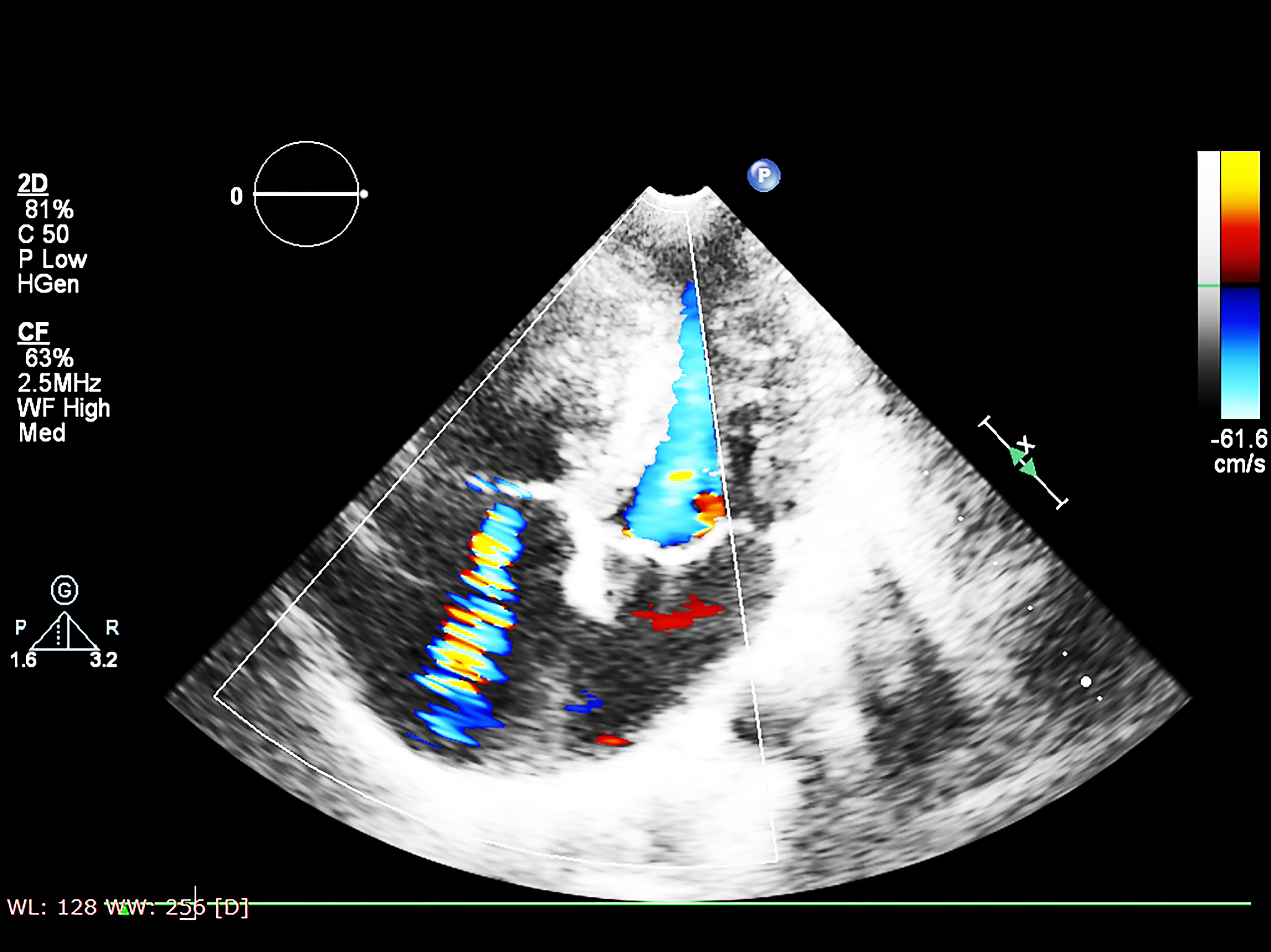 腔内超声造影在胆道疾病中的应用：精准诊断与治疗的新技术