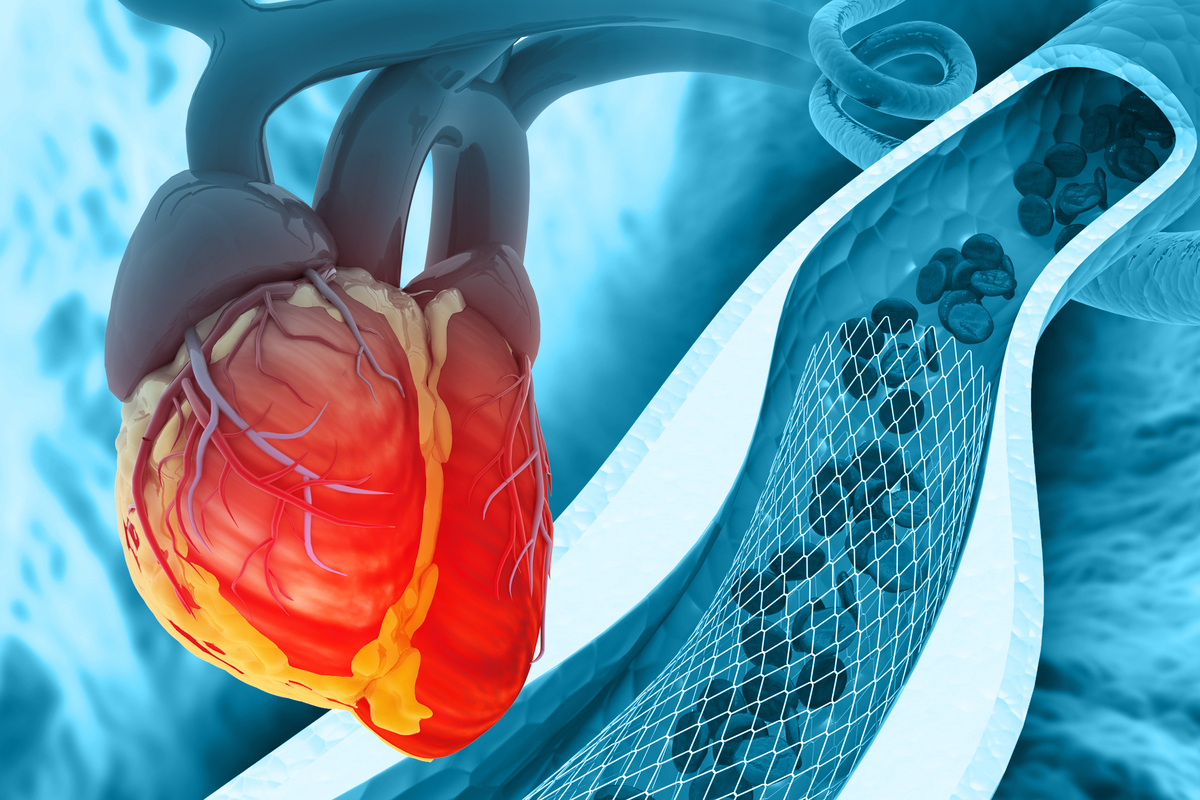 心脏早搏消融术做的不是很完美怎么办