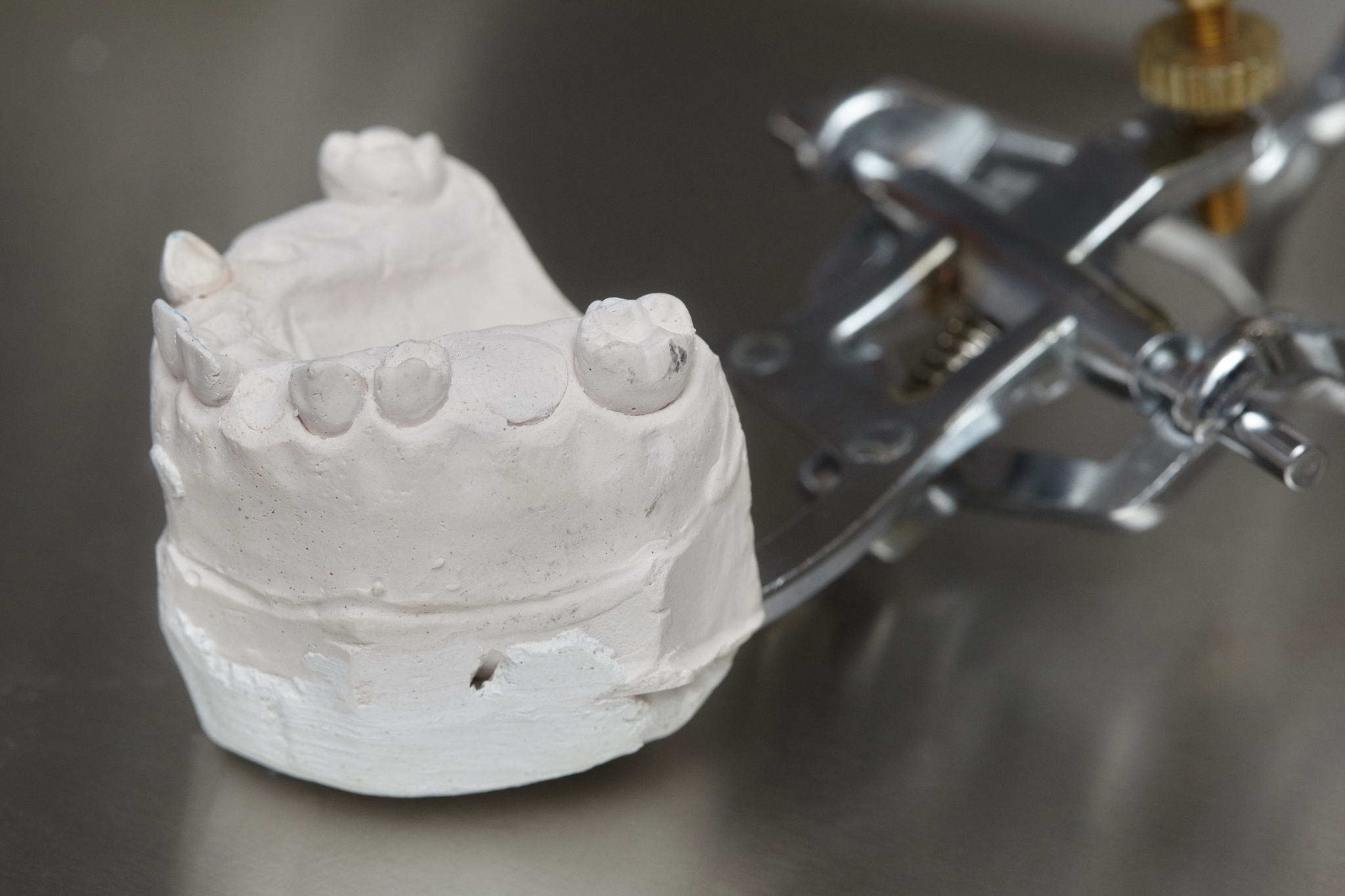 打印镂空结构对牙模的影响500字