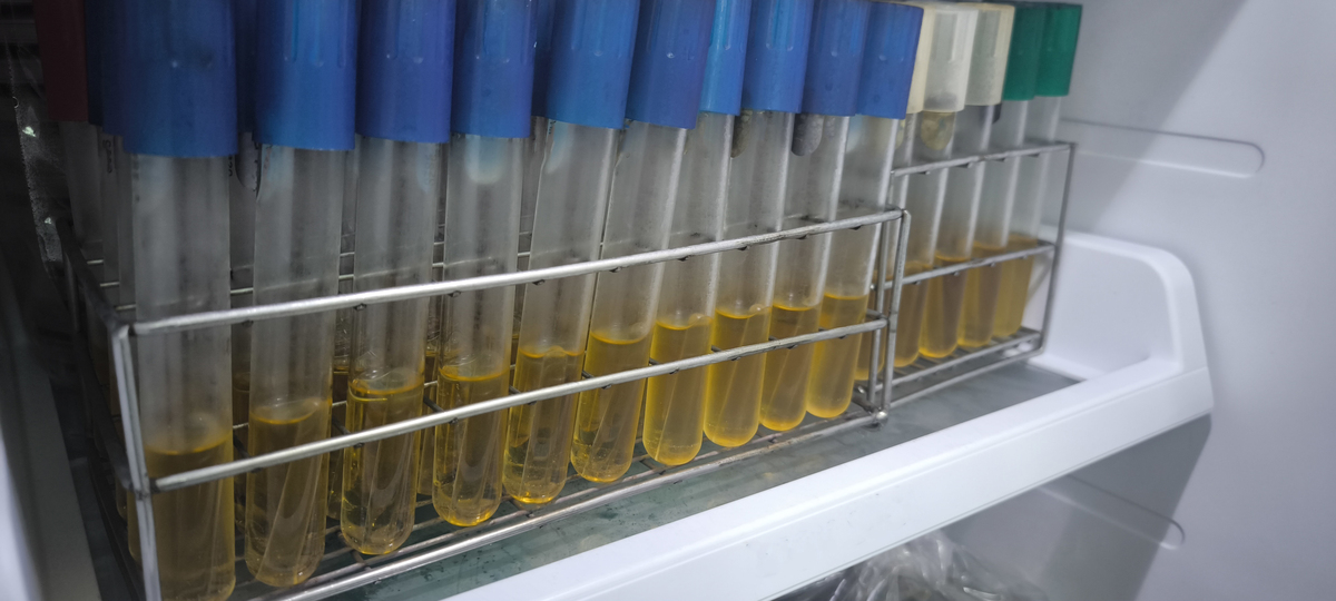 临时保存菌种的培养基：原理、类型及关键成分