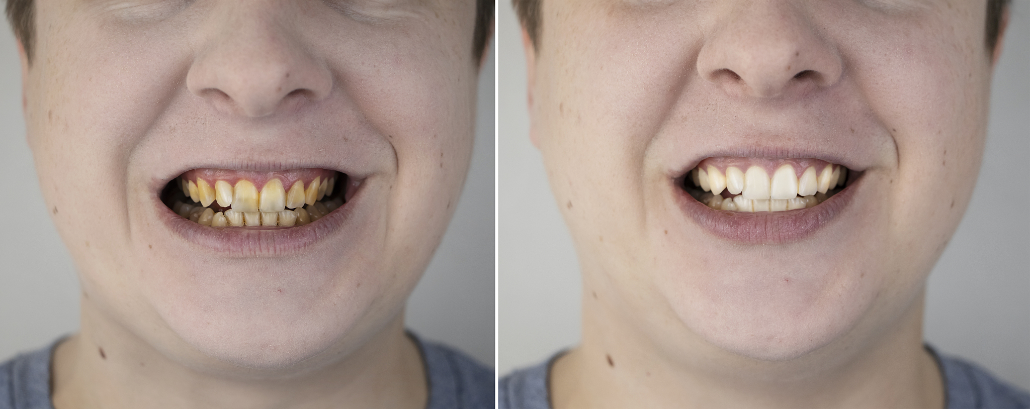 北京哪个口腔医学专业学校好用