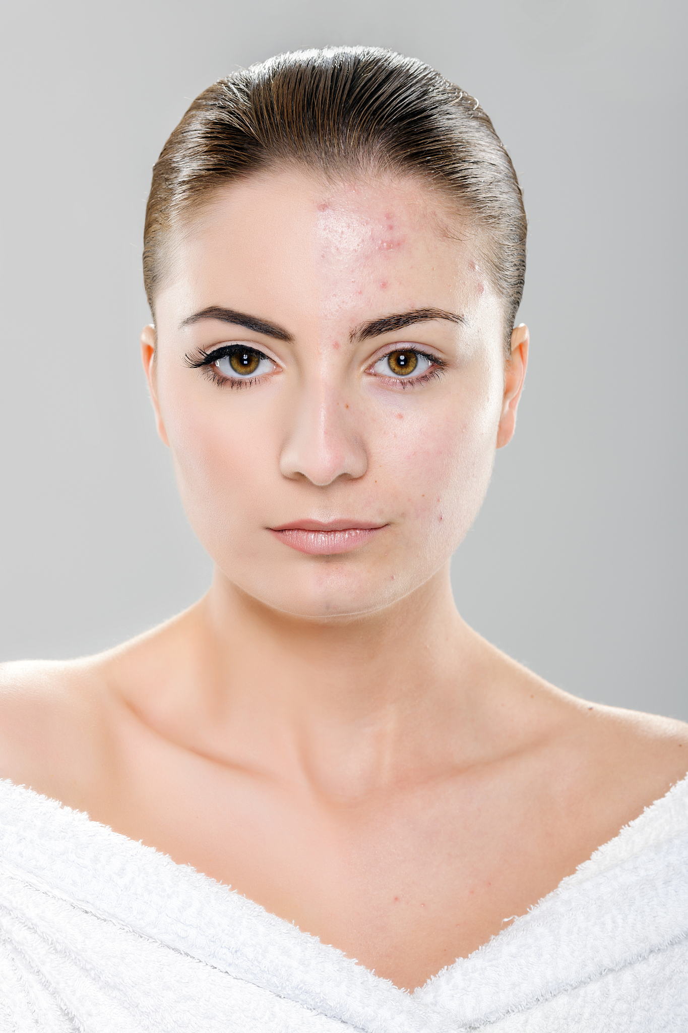 before after beauty retouch