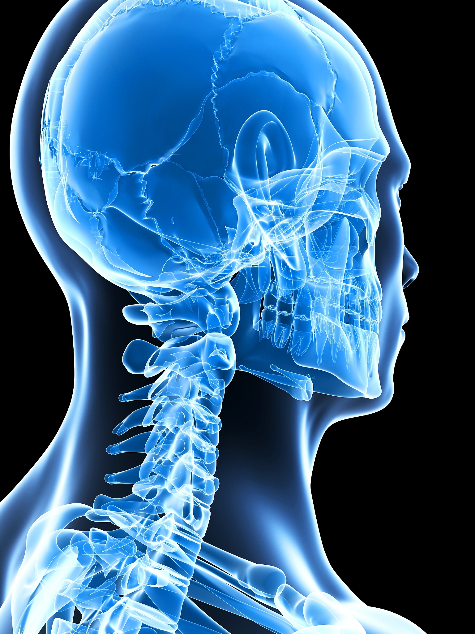 扭脖子会致命吗？ - 了解颈部损伤的风险