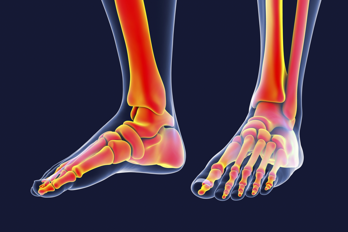 踝关节扭伤名词解释