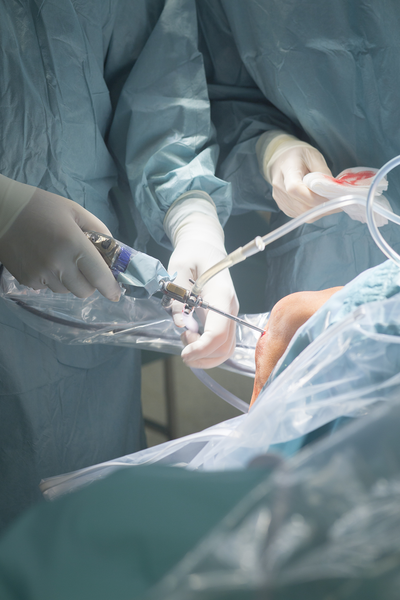 knee keyhole surgery hospital arthroscopy operation medical proc