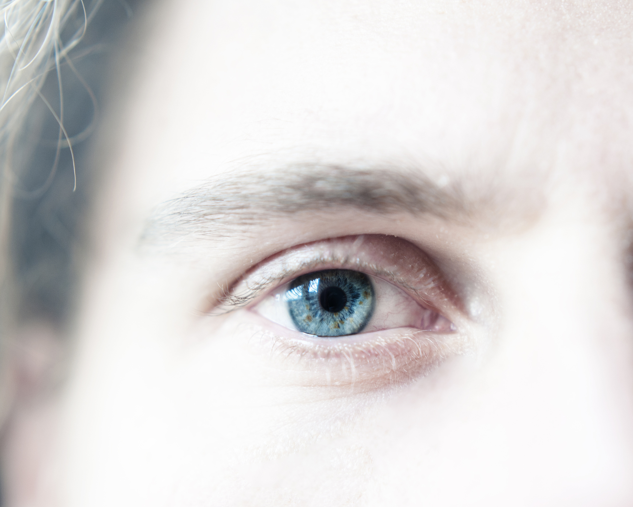 blue eye