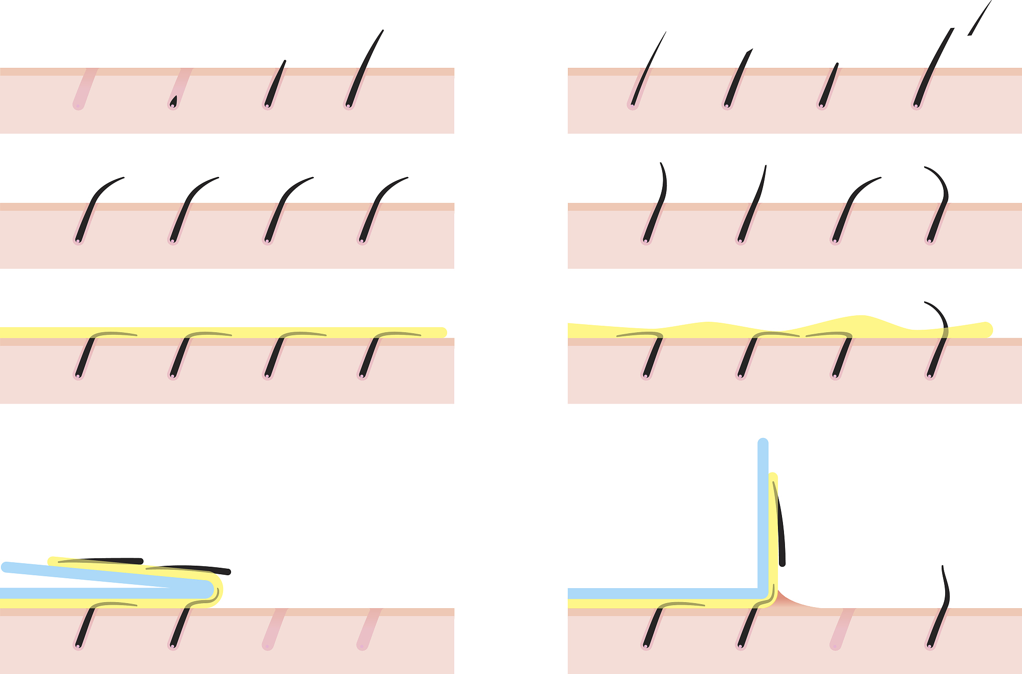 体毛为什么越脱越硬？