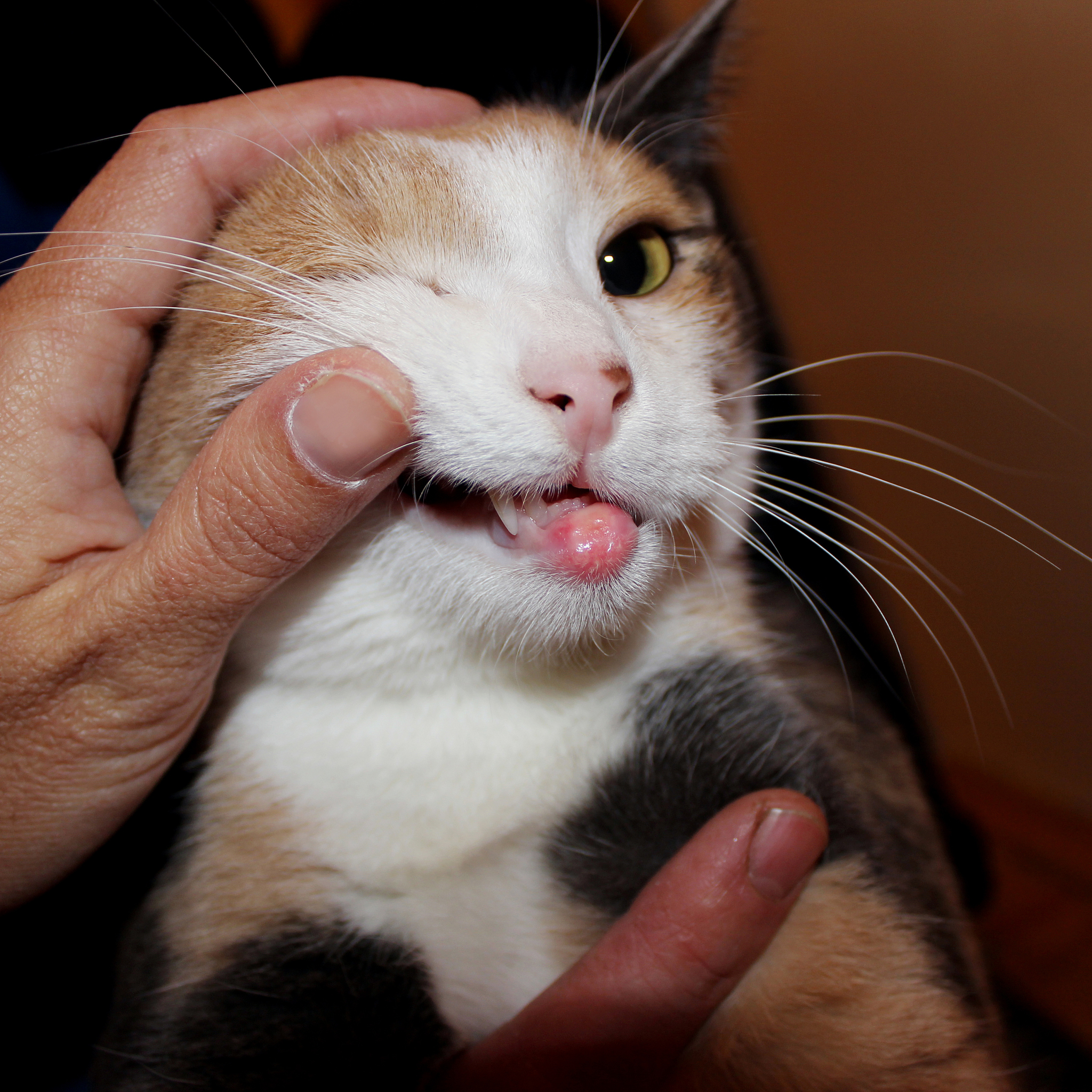 米粉过敏的症状