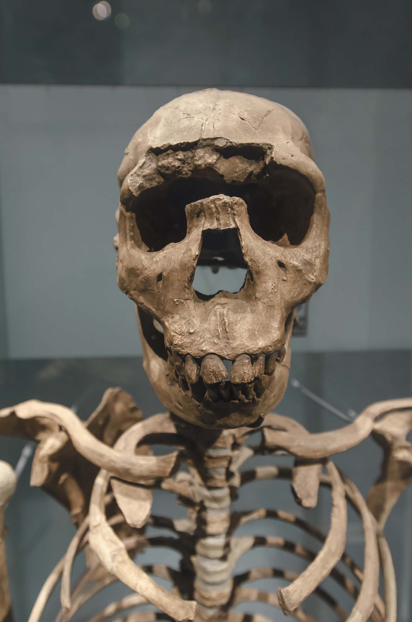 turkana boy