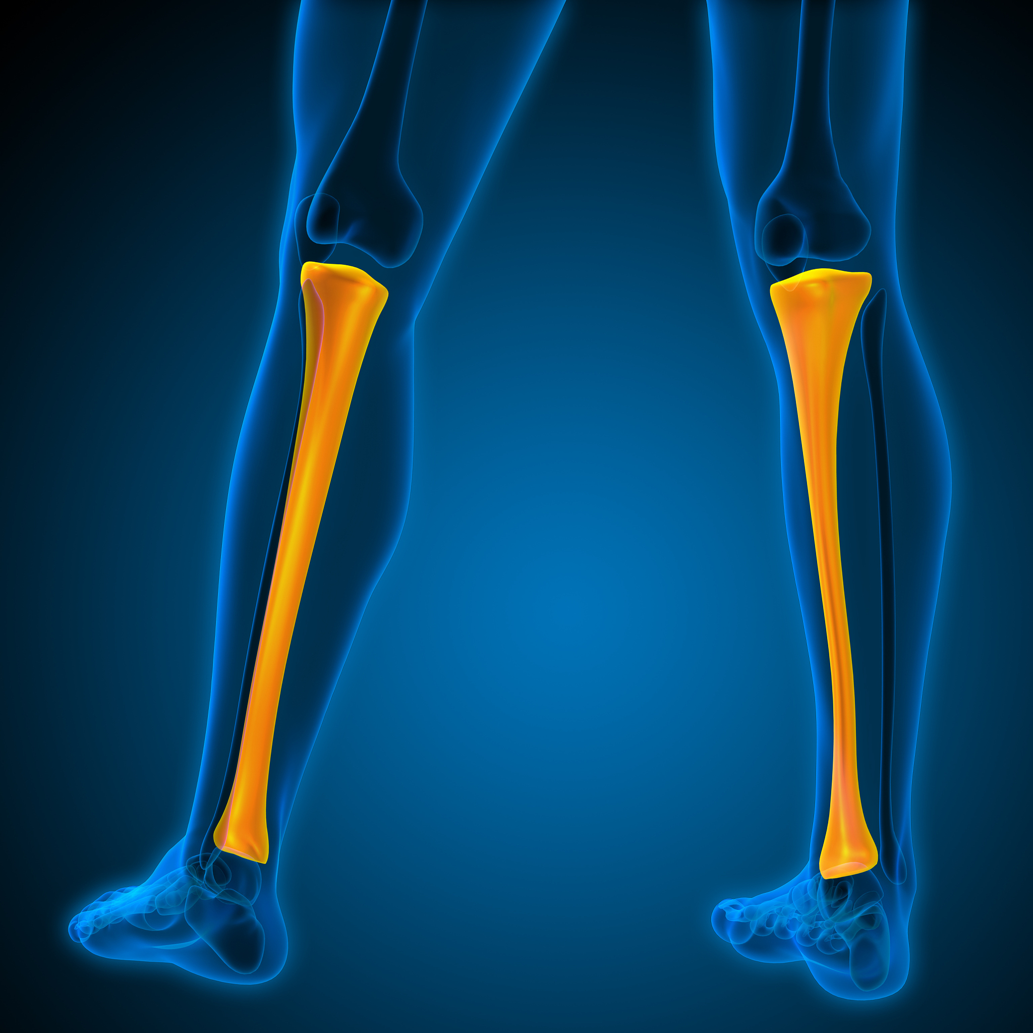 距腓前韧带损伤全镜下治疗：显著疗效