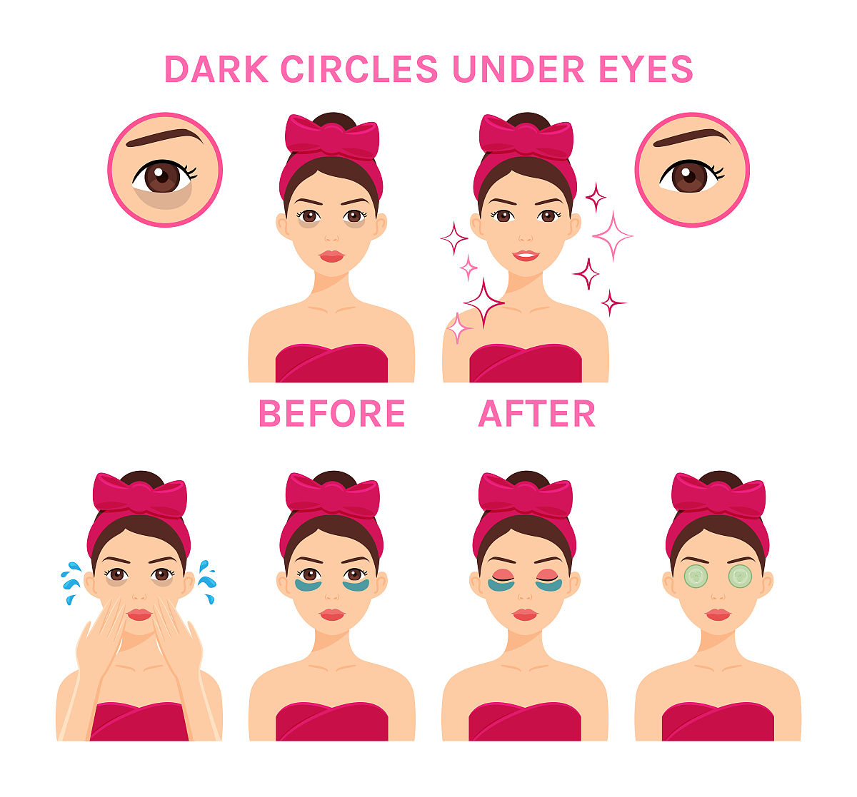 黑眼圈能自动消失吗？如何有效去除黑眼圈？