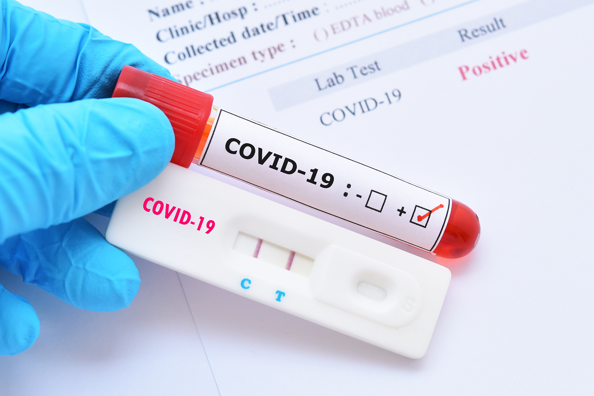 positive test result by using rapid test device for covid-19 vir