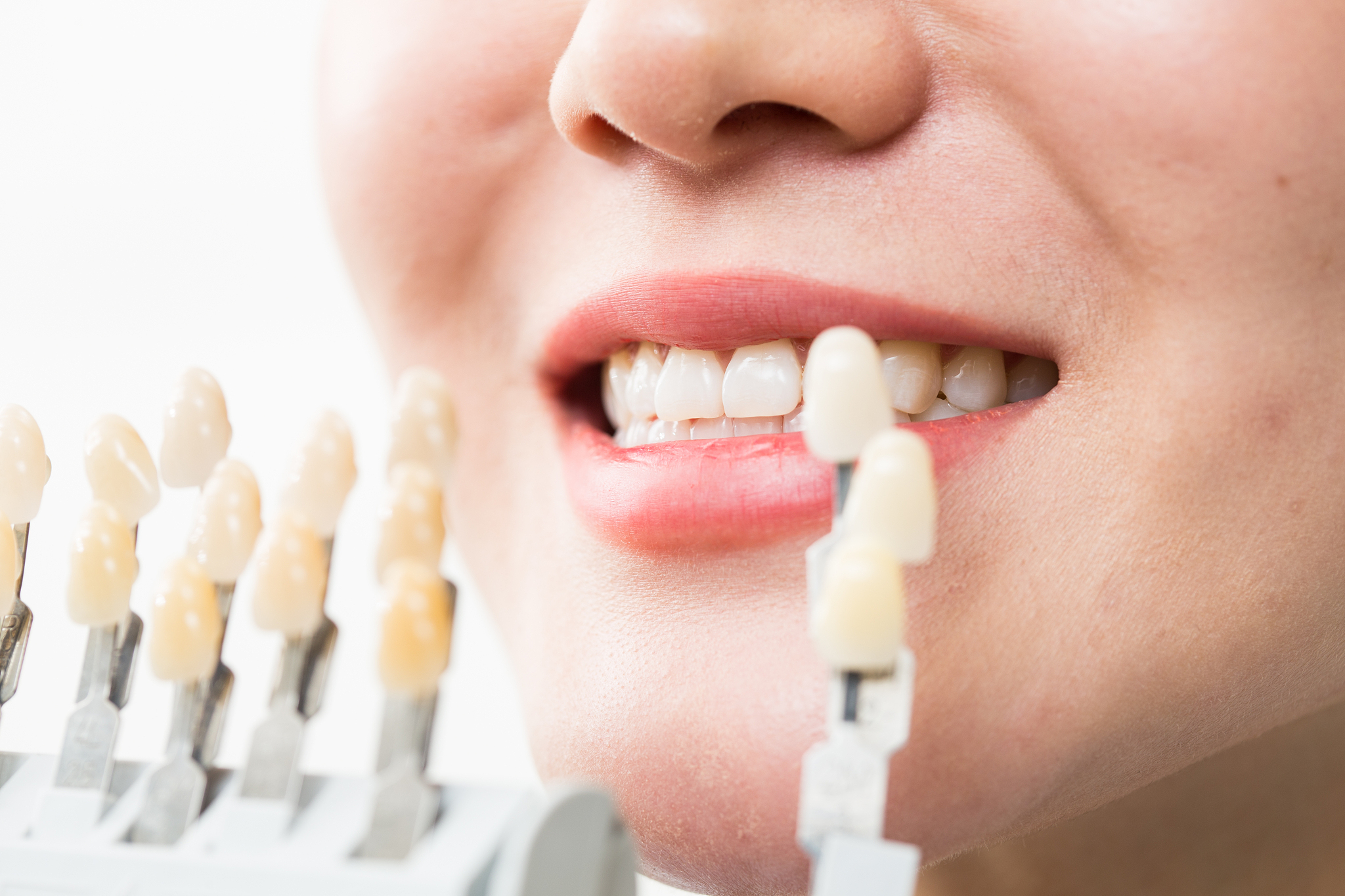 牙齿美白：方法、护理和健康建议