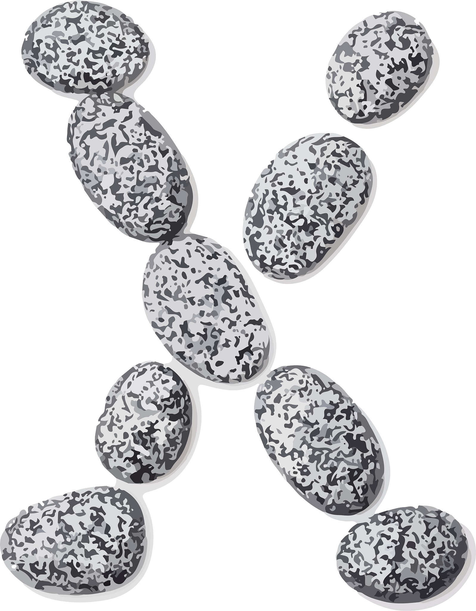 肾结石和膀胱结石和胆结石还有胃结石区别 英文一千字 带标题