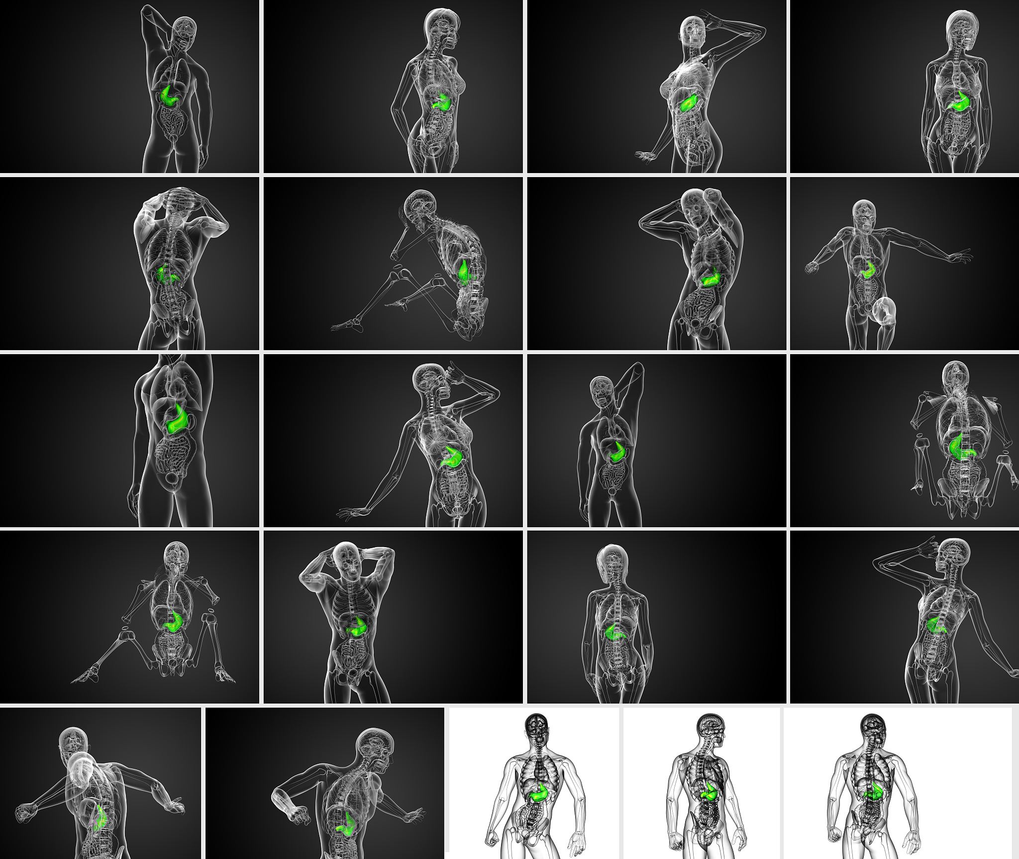 Dalal等人提出方向梯度直方图HOG算法是什么