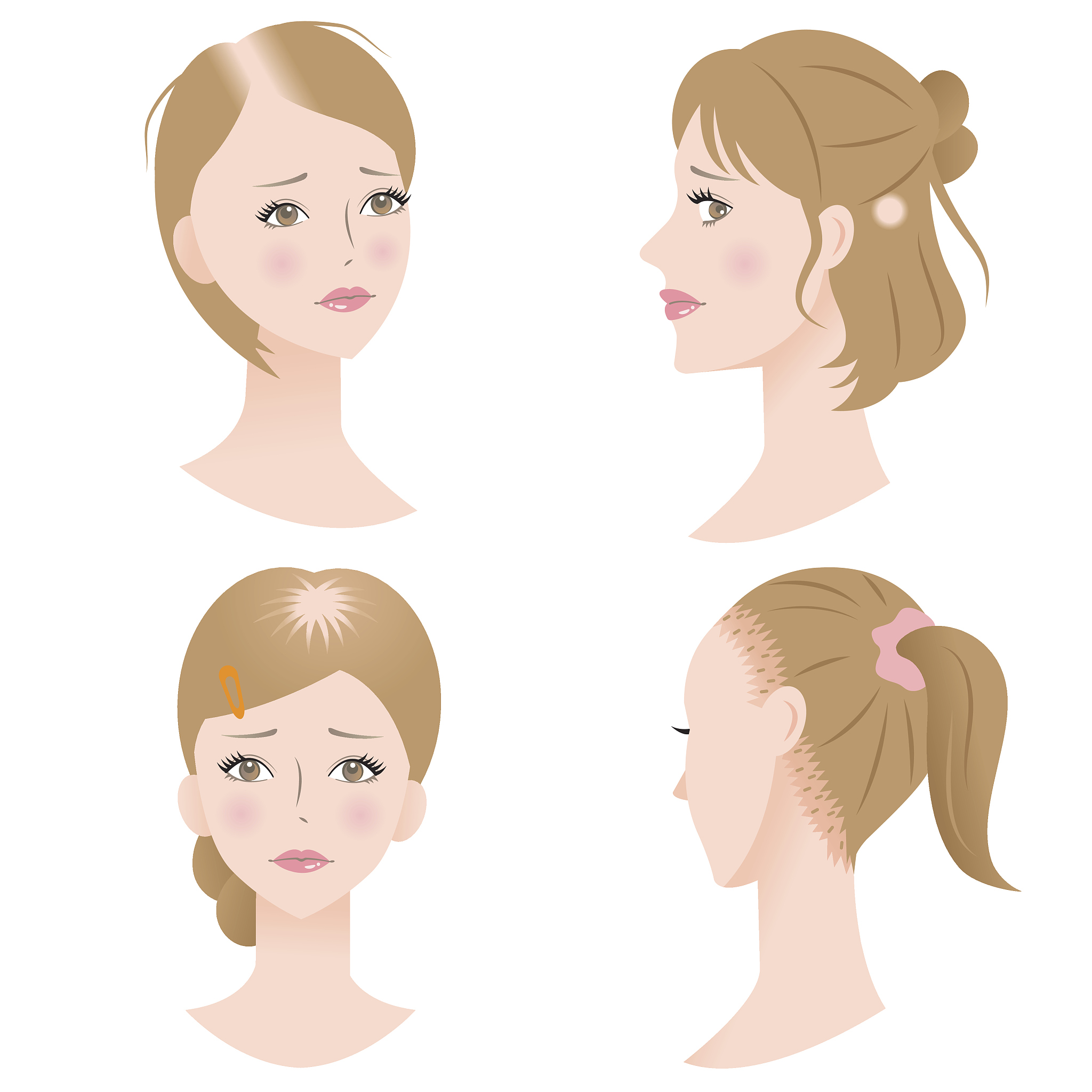 B2V护发素：滋养秀发，防止干枯断裂