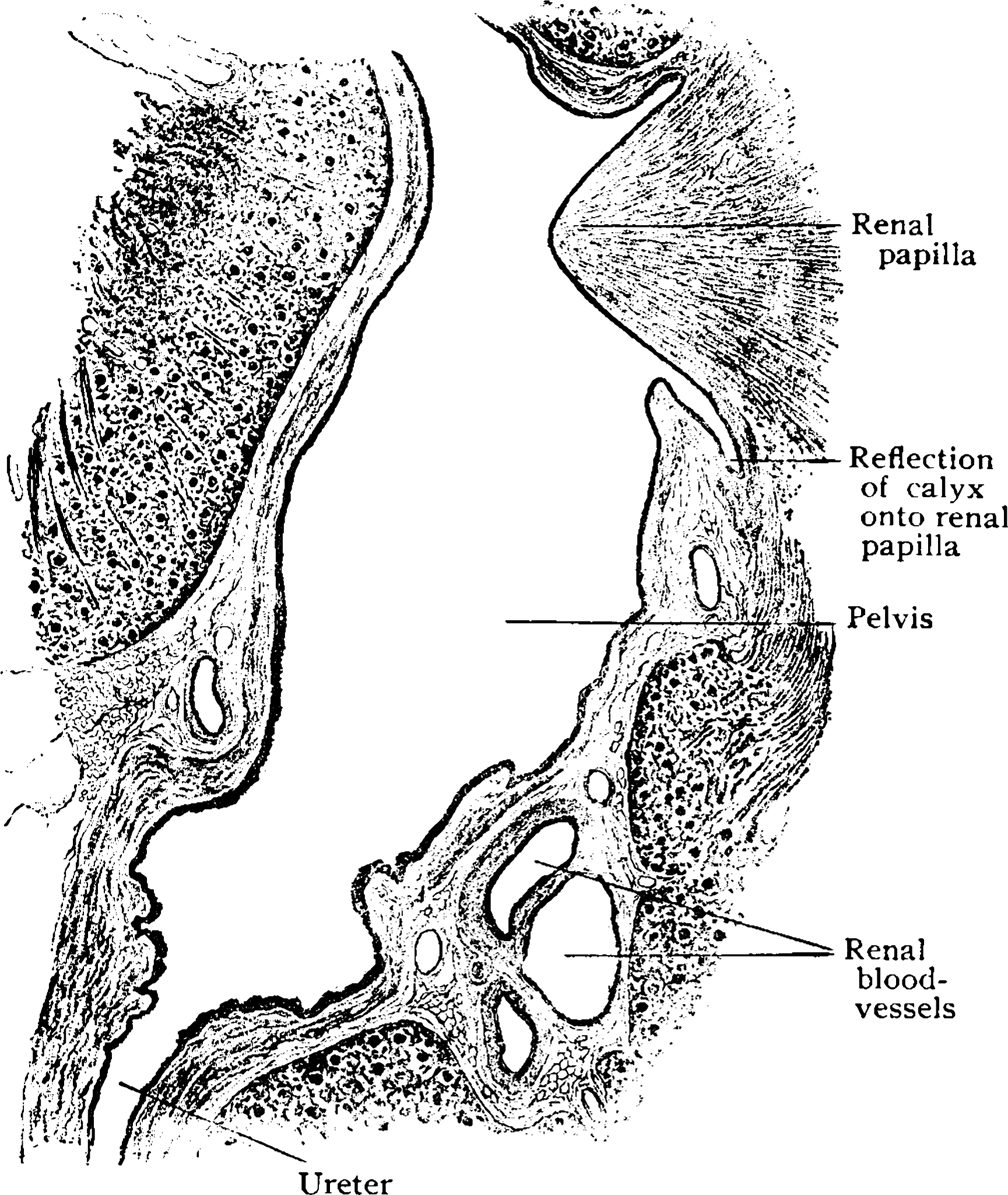 结肠胸腔切开术(Colothoracotomy): 手术步骤、适应症与风险