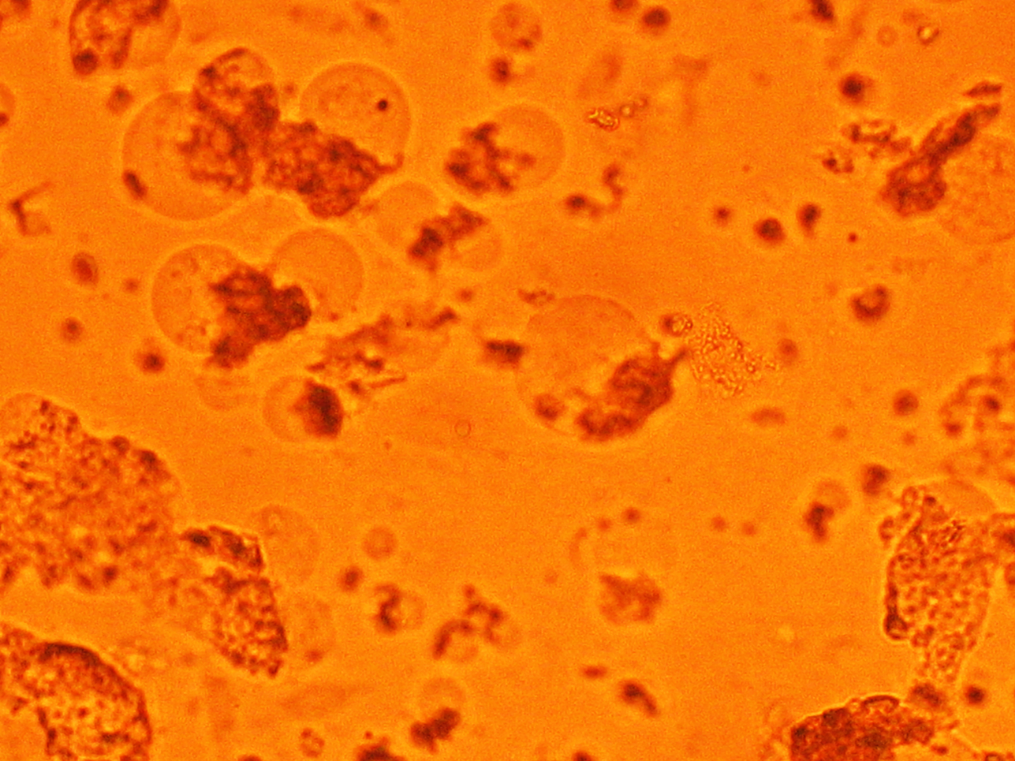 瘰疬分枝杆菌：常见致病菌？免疫力低下人群需警惕！