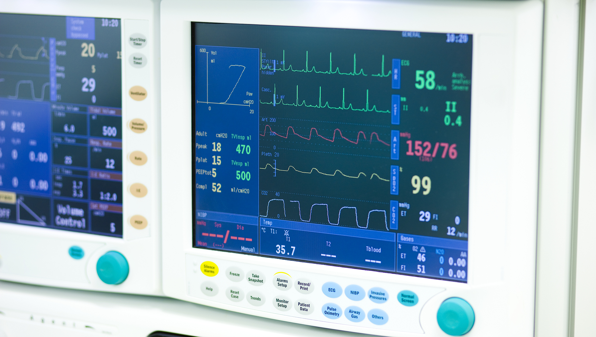 手术生命体征监测：保障手术安全的重要环节