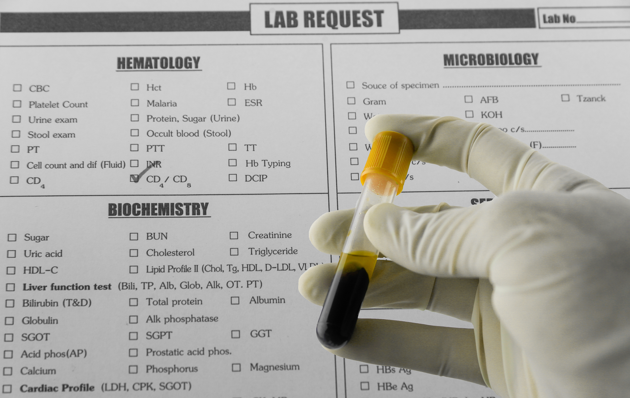 透明质酸分子量对ELISA检测结果的影响及分析