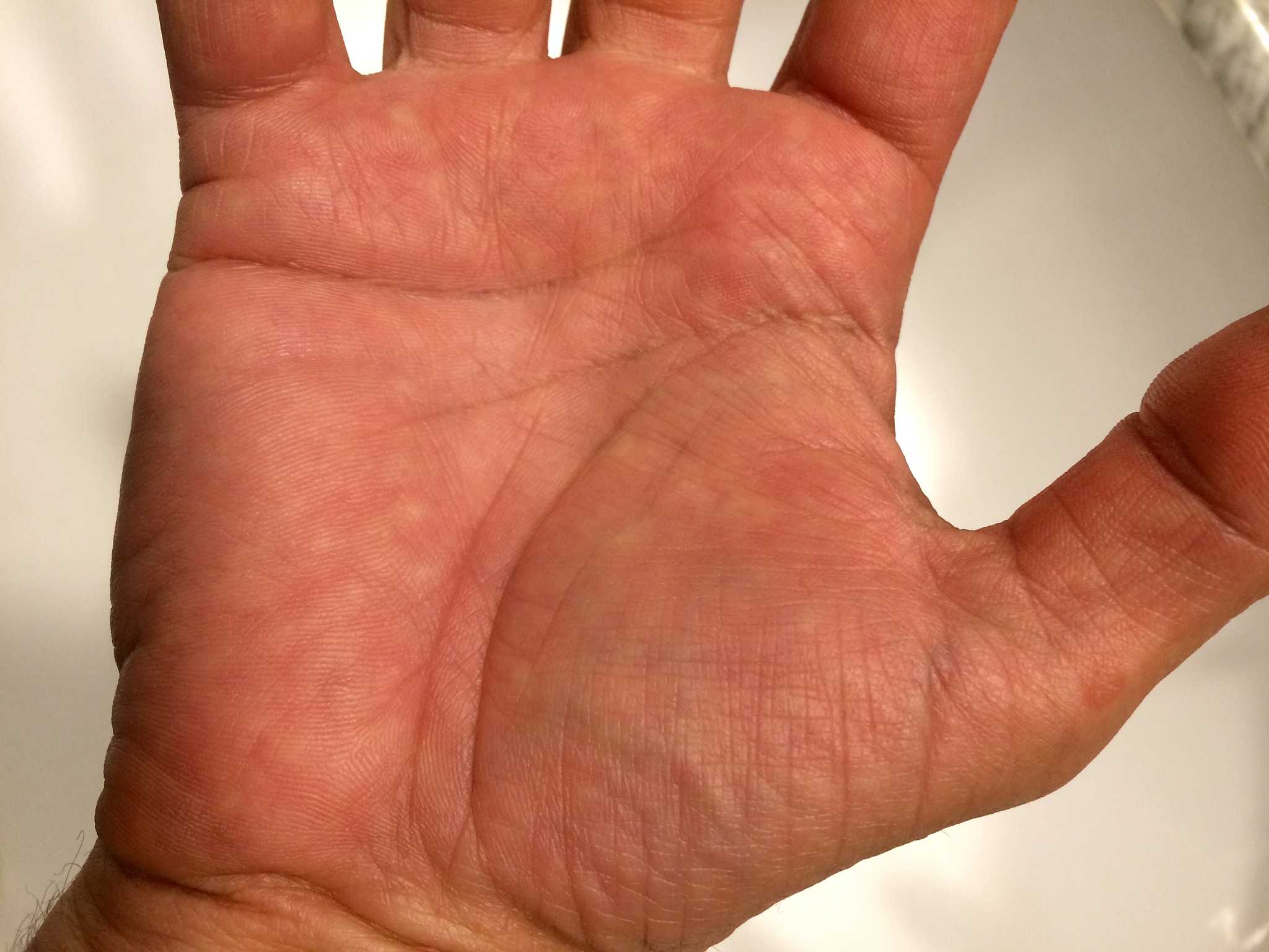 手上朱砂痣代表什么？300字以上详细解读