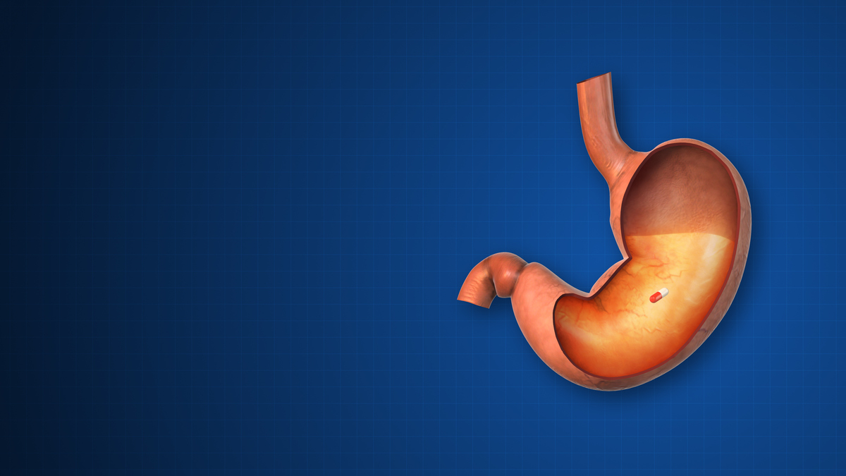 胃疼怎么办？缓解胃痛的6个方法