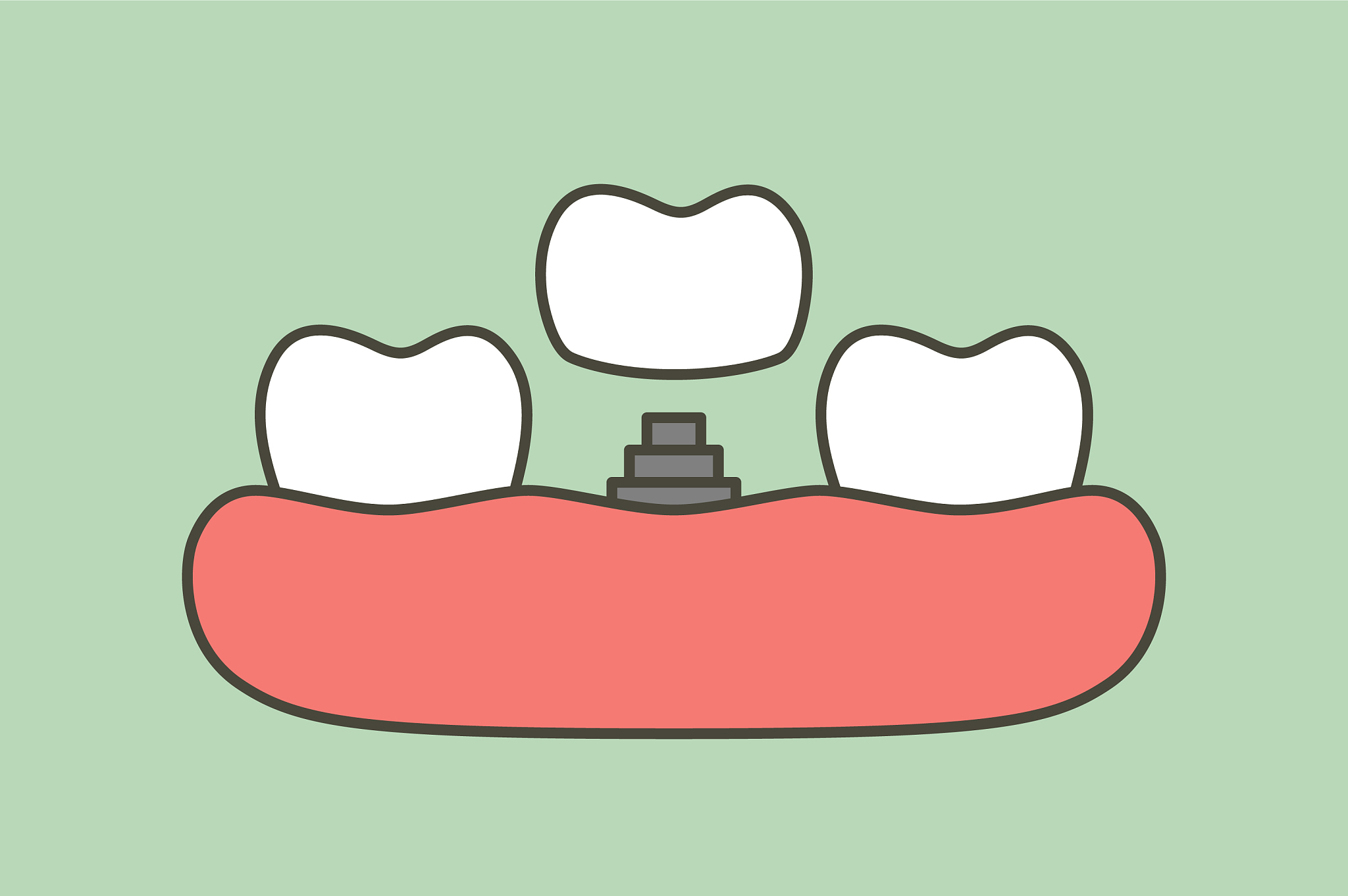 2023年京山卫生学校招生专业有哪些-好不好