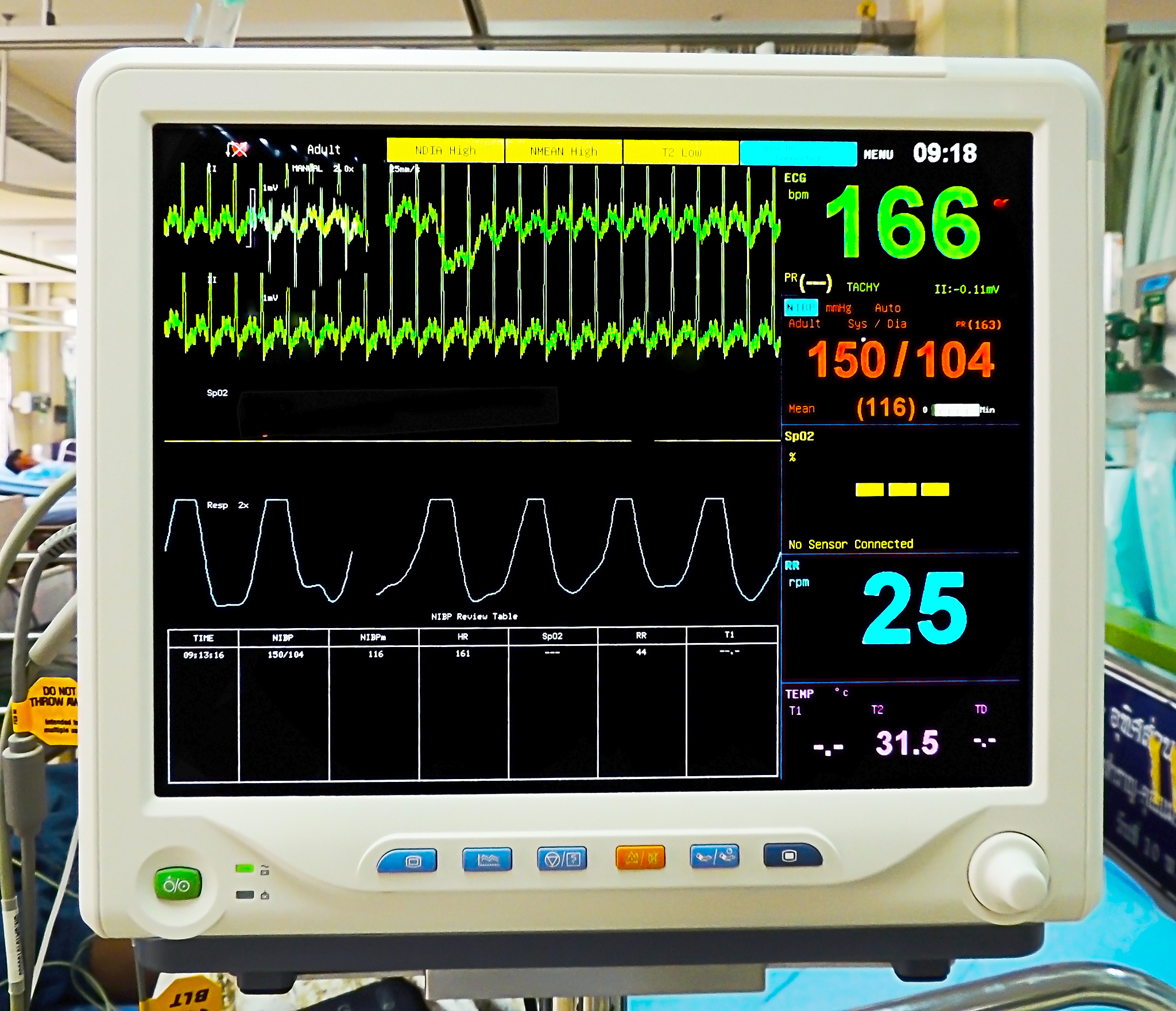 呼吸机工作原理及模式详解：相位、通气方式、CPAP、PEEP等