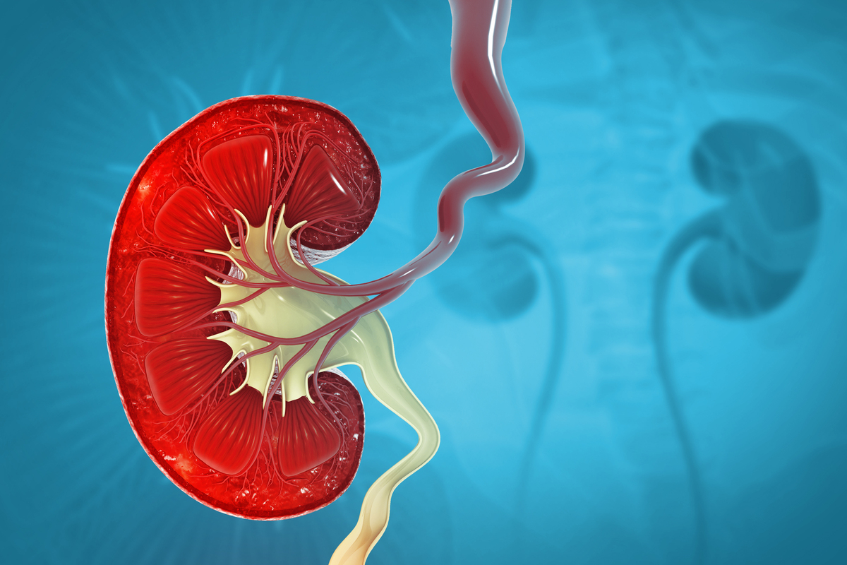 肾积水是什么原因引起的