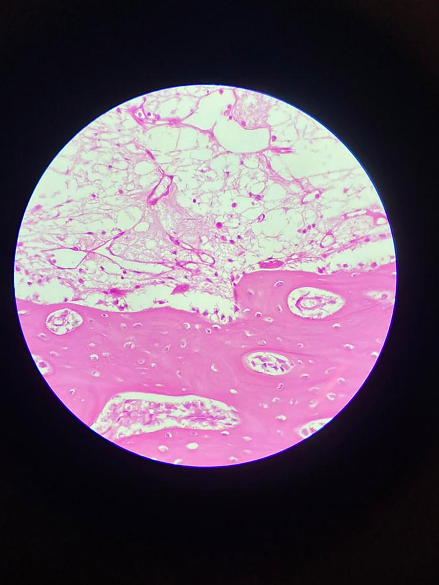 肌成纤维细胞巨噬细胞纤维化