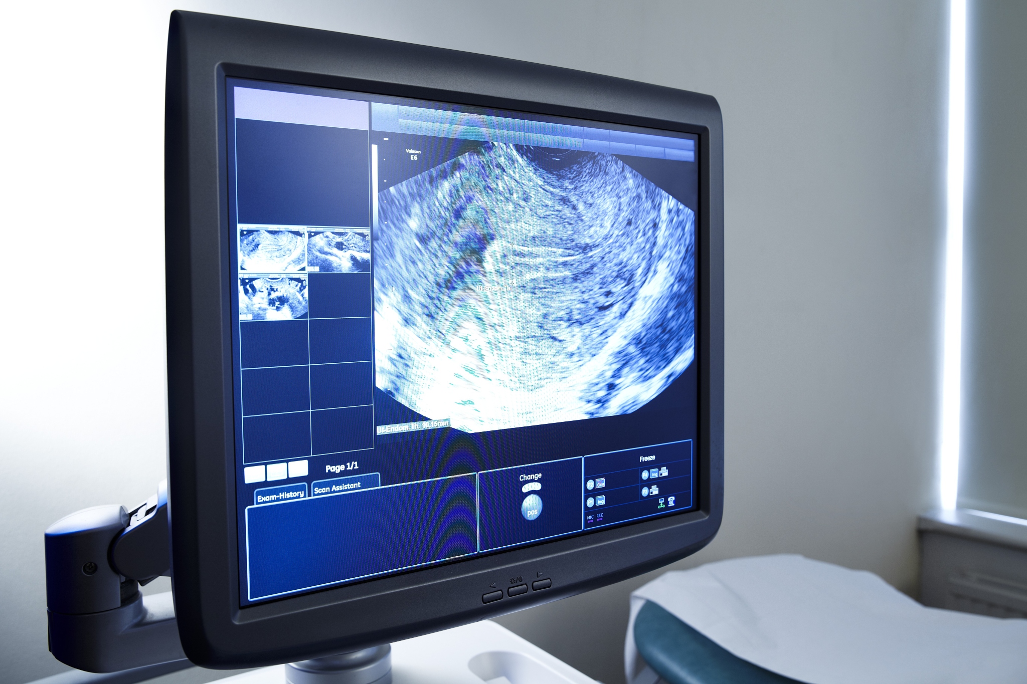 超声介入领域的未来趋势：智能化、高精度、多样化