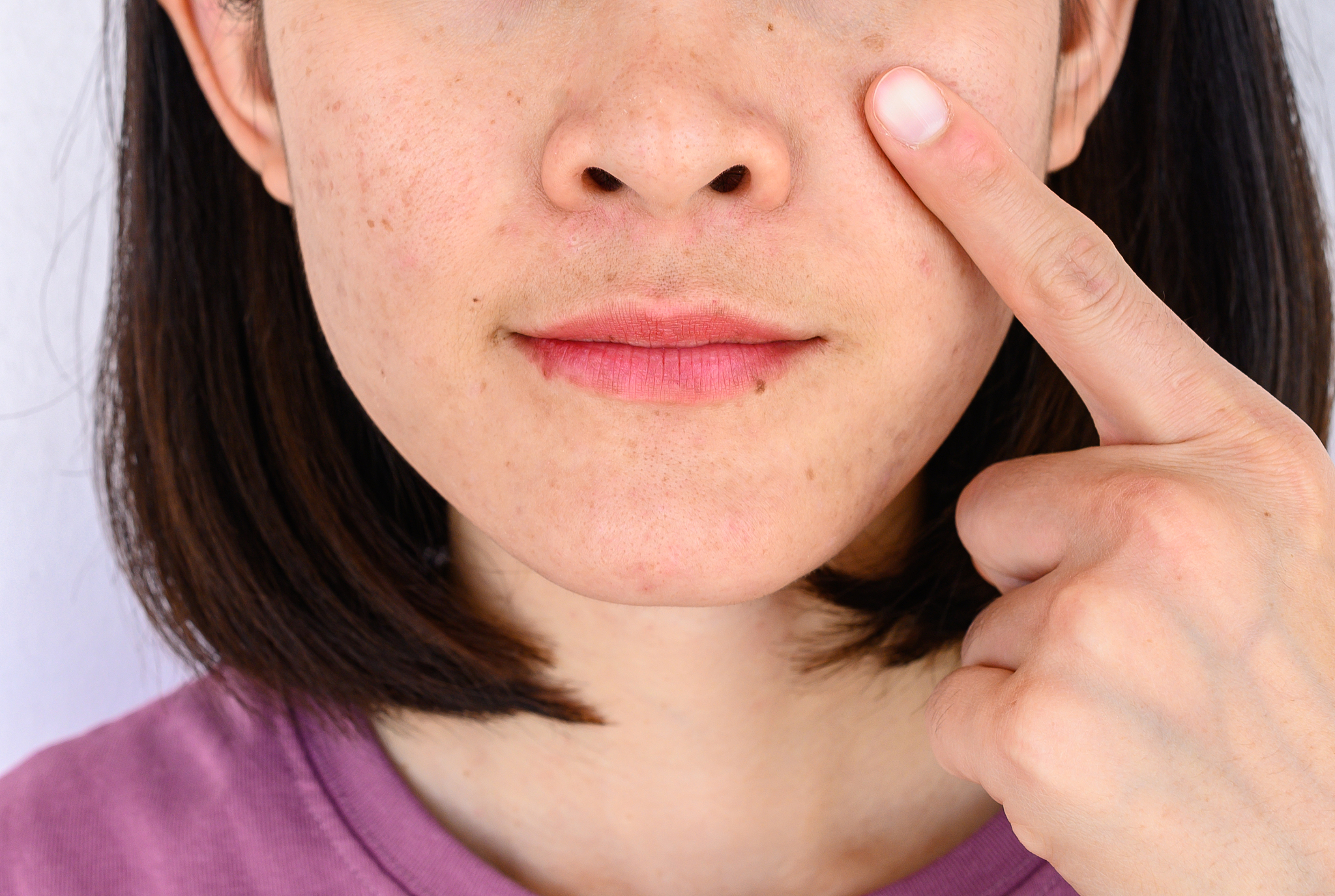 close-up of woman pointing a problem on her face with variety pr