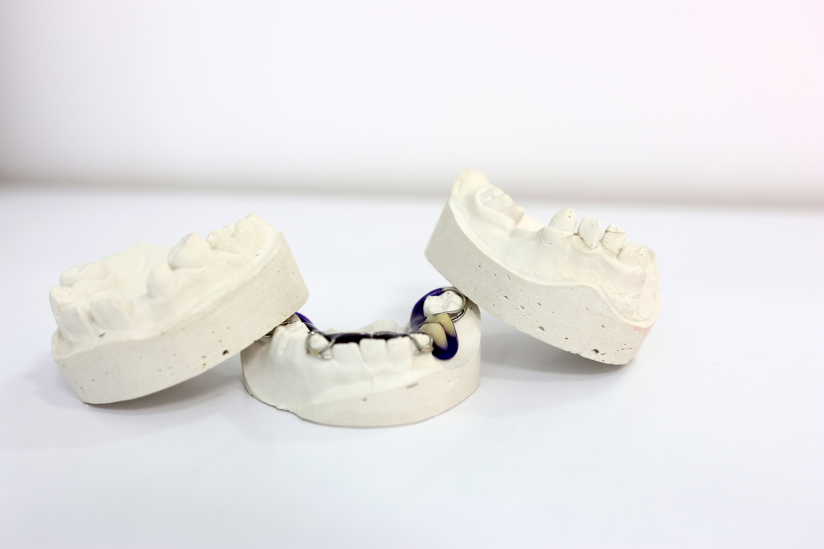 齿科3D打印技术研究：提高效率与精准度，助力牙齿修复与重建