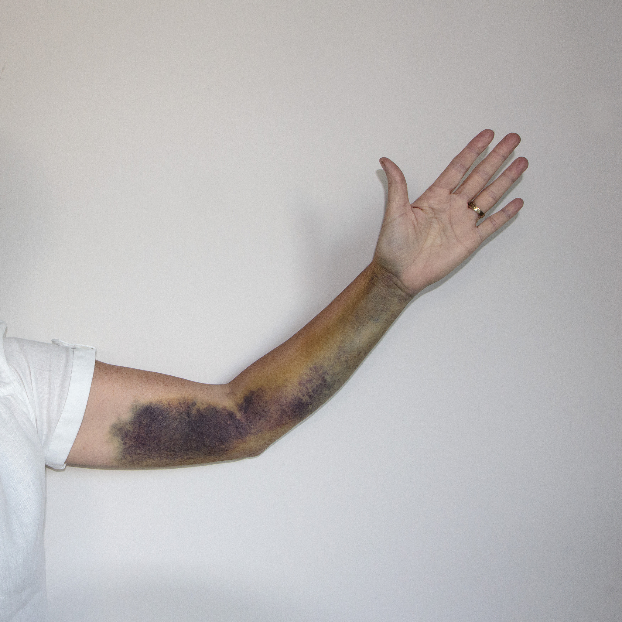 轻微伤的结果包含哪些