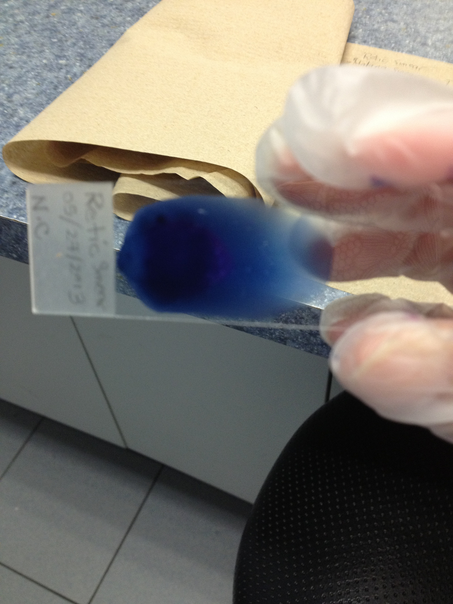 卫生巾可以止血吗？紧急情况下如何止血？