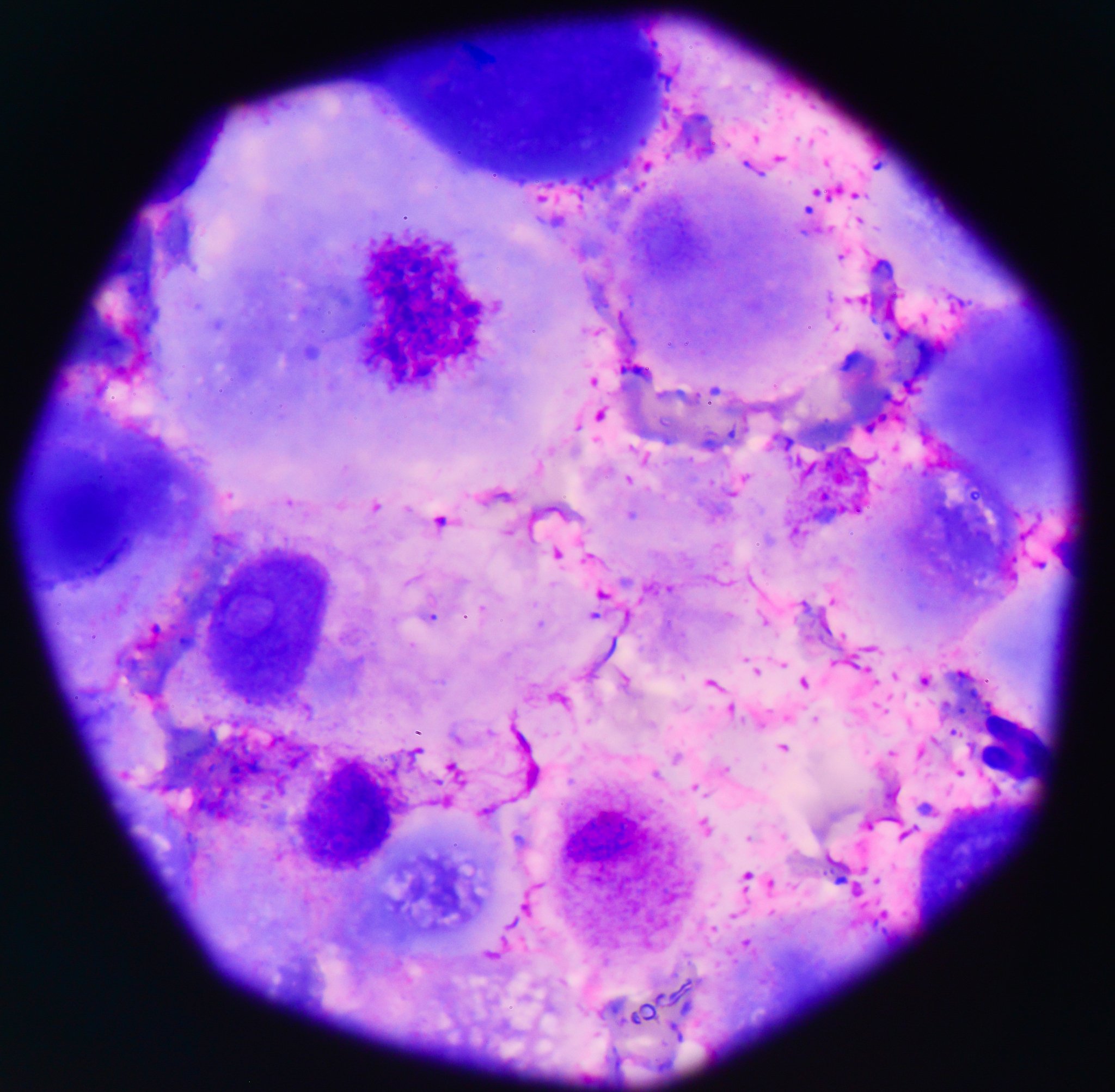 外周血中可以检测到kupper细胞么