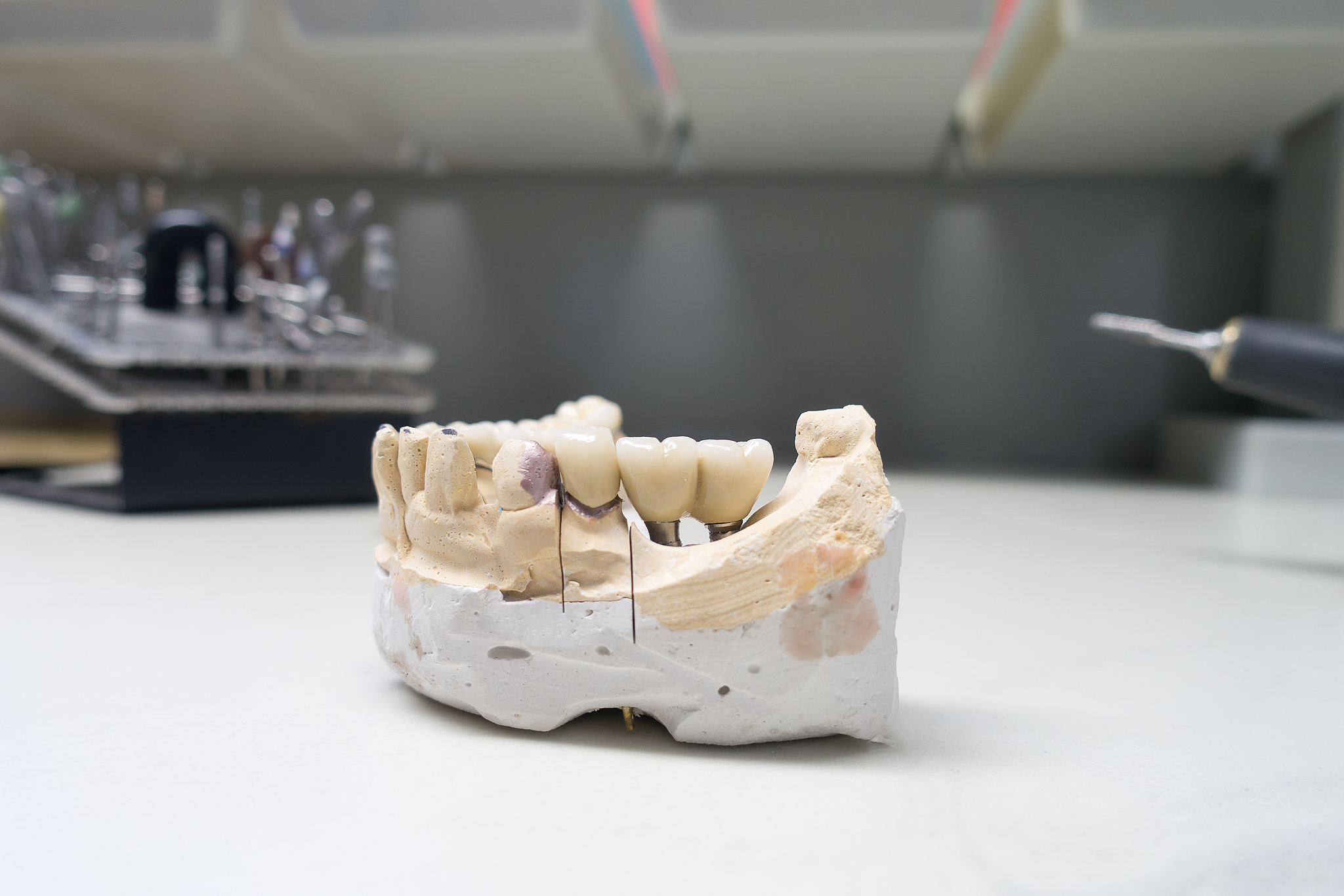 重庆卫校口腔修复工艺专业：发展趋势与未来方向