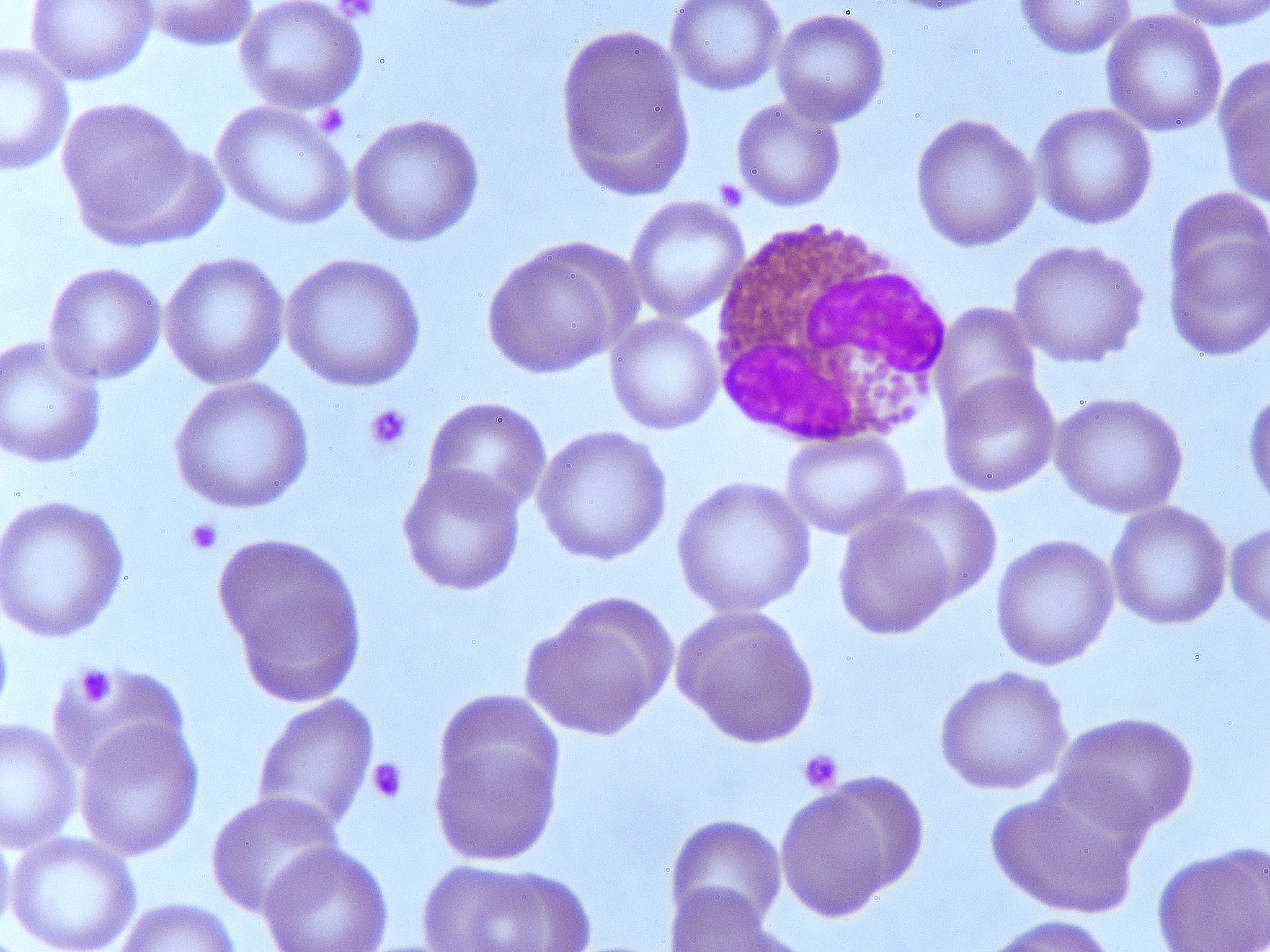 灵菌红素抑制金光色葡萄球菌诱导巨噬细胞炎症