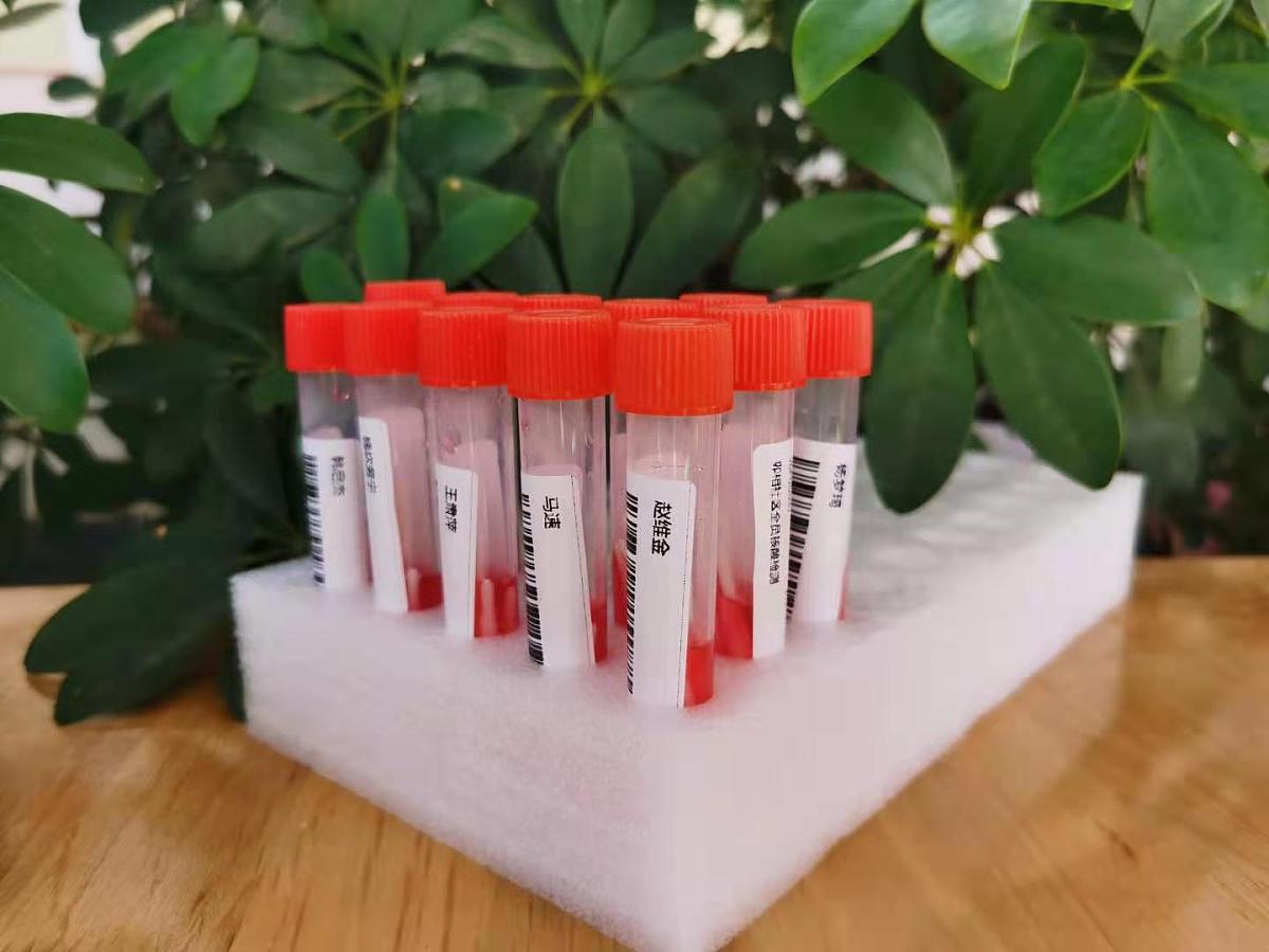 怎么判断尿蛋白量关于医疗健康的内科知识需要的工具、原料以及判断的方法和步骤