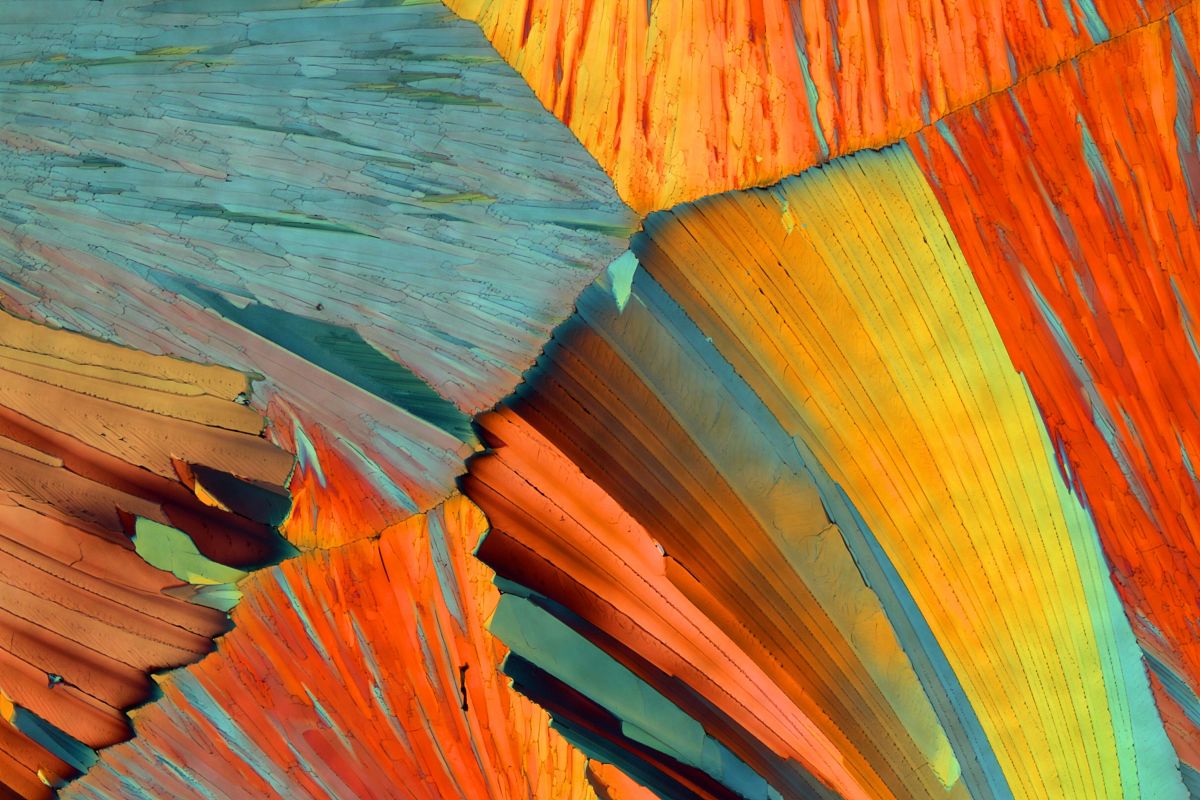 尿酸高是怎么导致的要注意什么