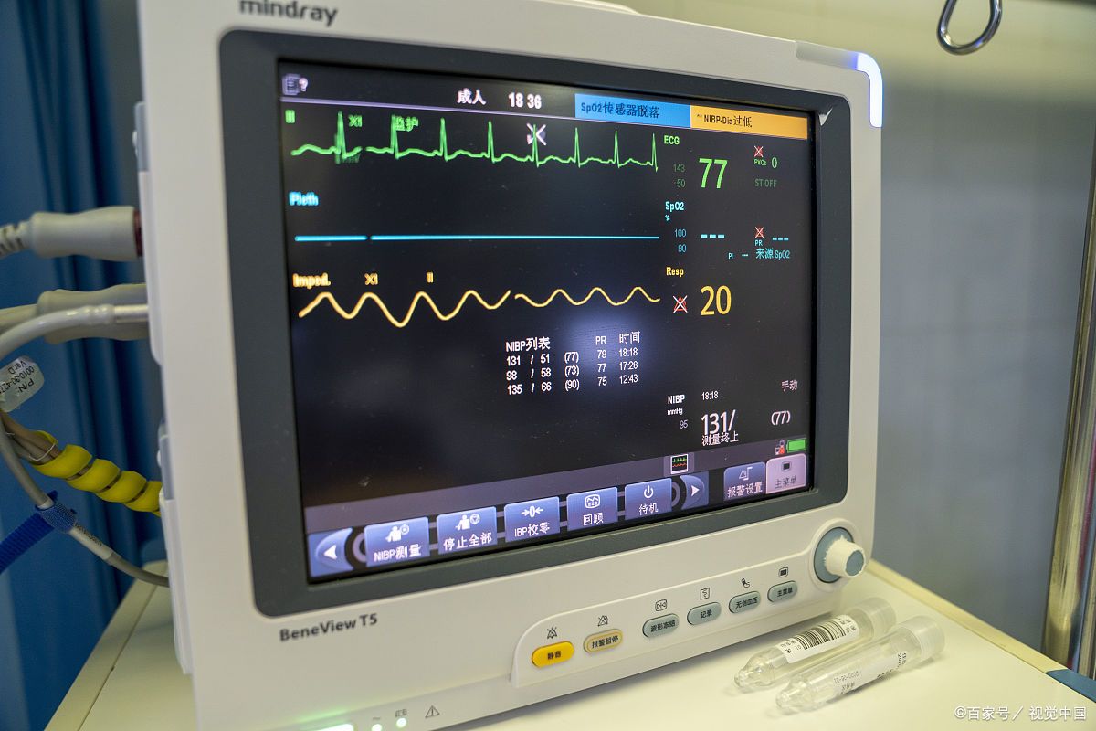 你想知道的心电监护常识,都在这里了