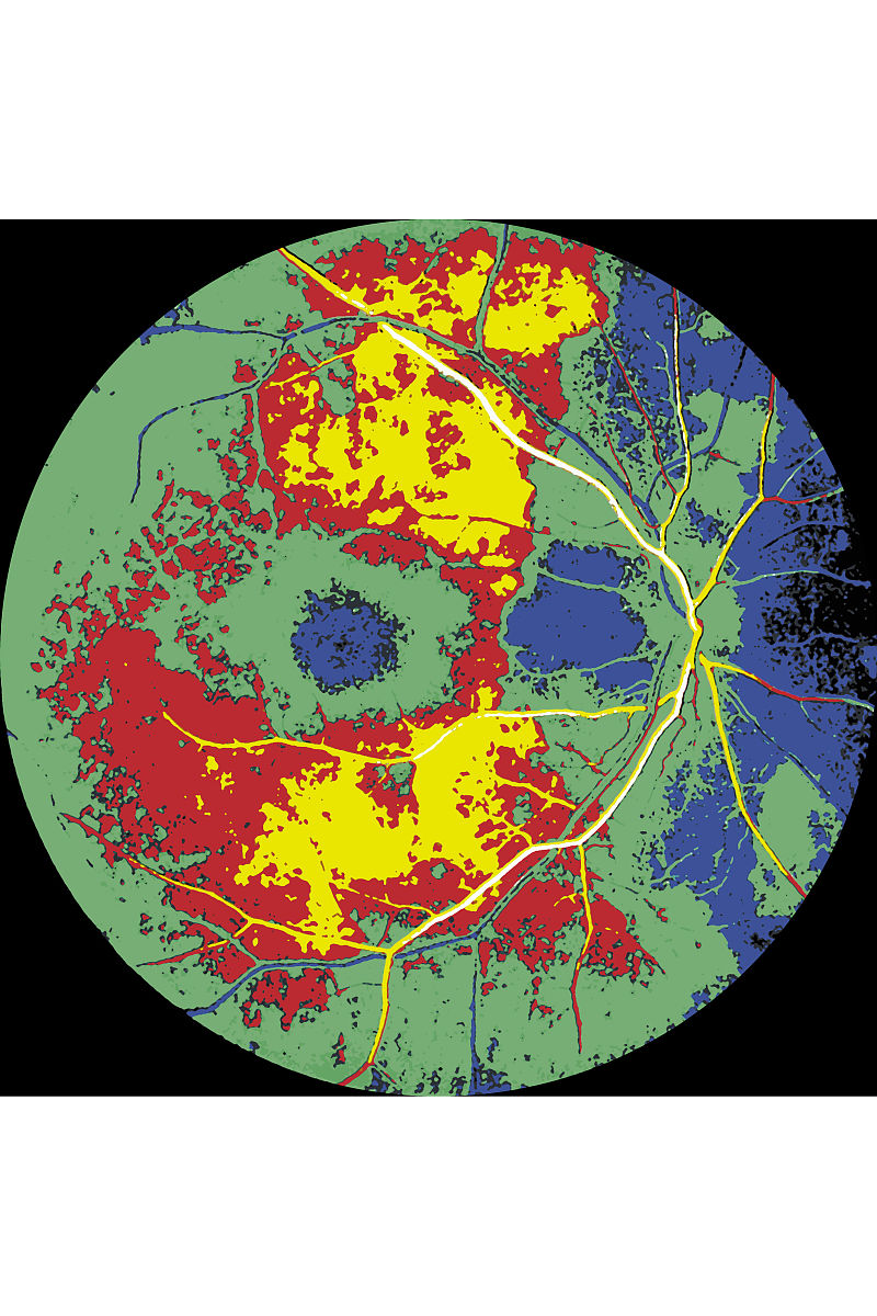 辐射带环境显示一般用什么图