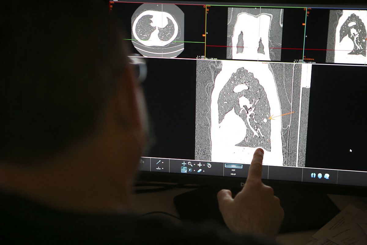 请写一段python代码使其实现读取一个文件夹下所有的niigz格式的三维CT图像并进行可视化其正视图并在同一个窗口中同时加载正视图的mask每可视化一次就暂停由用户决定选择下一张图片使用SimpleITK库